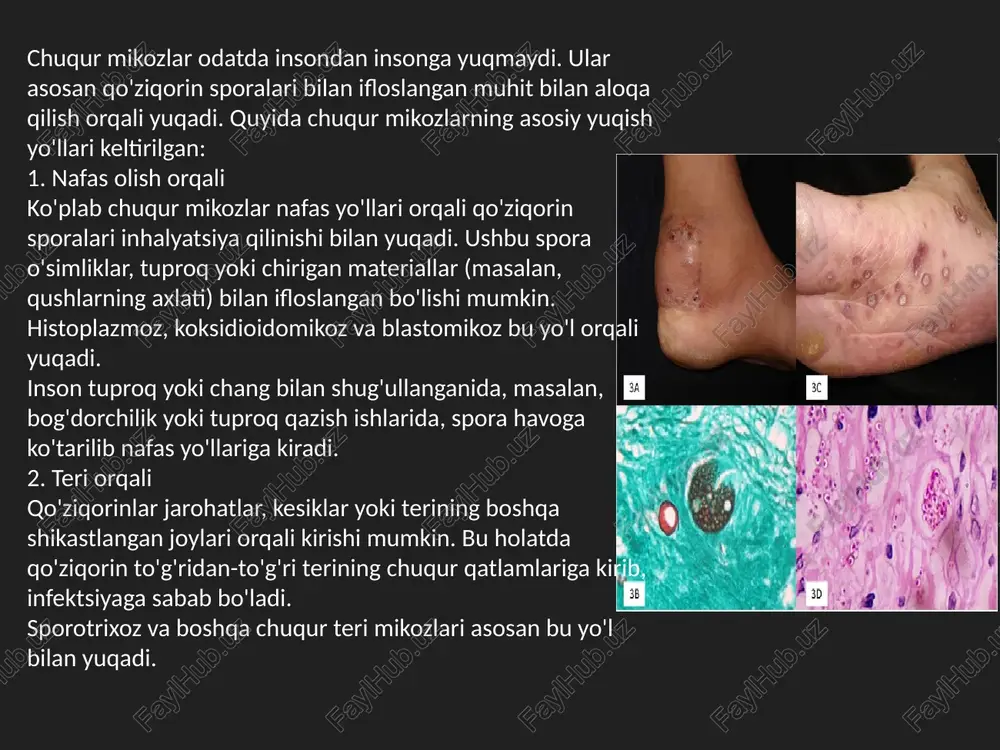 omatlar: isitma charchoq va zaiflik ozish va ishtahaning yo'qolishi maxsus mikozlar klinikasi: histoplazmoz: asosan o'pka simptomlari, lekin dissiminasiyalangan shakllari jigar, taloq va suyak iligiga ta'sir qilishi mumkin. blastomikoz: o'pka, teri va suyaklarni zararlashi bilan namoyon bo'ladi. koksidioidomikoz: nafas olish simptomlari, o'pka kasalliklari va ba'zan suyaklar, miya va teriga ta'sir ko'rsatadi. kandidiyoz: qo'ziqorin ichki organlarga (masalan, yurak, buyrak) zararlashganda, sepsis va boshqa og'ir holatlar rivojlanishi mumkin. diagnostika: mikroskopik tekshirish va madaniyati qo'ziqorin antigenlari uchun qon va balg'am tahlillari rentgen va kompyuter tomografiyasi (infeksiya joylashgan joylarni aniqlash uchun) erta tashxis va davolash og'ir asoratlardan qochishga yordam beradi. chuqur mikozlarning davolash usullari infeksiyaning turi, joylashuvi va bemorning umumiy sog'lig'iga qarab farqlanadi. asosiy davolash antifungal preparatlar bilan amalga oshiriladi, lekin ba'zi holatlarda jarrohlik aralashuvi ham talab qilinishi mumkin. asosiy davolash usullari: 1. antifungal dori vositalari amfoterisin b: juda kuchli antifungal preparat bo'lib, ko'plab chuqur mikozlar uchun qo'llaniladi. u vena ichiga yuboriladi va og'ir holatlarda …