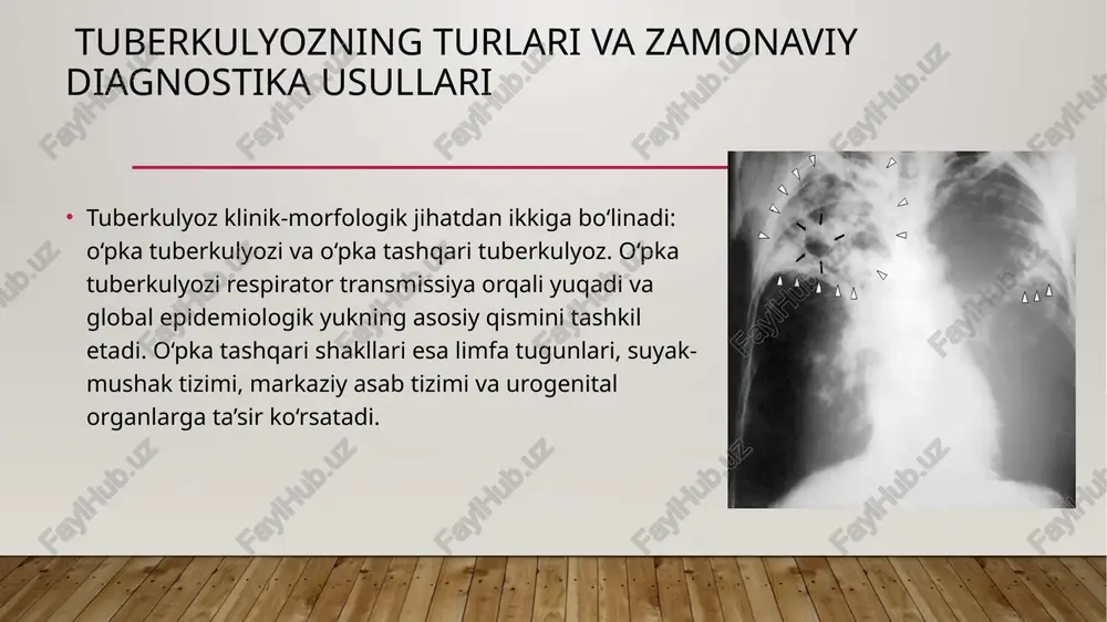 sal foydalanish uchun ishlab chiqarish. global monitoring va moliyaviy ta’minot – xalqaro donorlar va davlat investitsiyalari orqali tuberkulyozga qarshi kurashning samaradorligini oshirish. o‘zbekiston respublikasi milliy strategiyasi: populyatsion skrining dasturlarini kengaytirish – xavf ostidagi guruhlarda tbni erta aniqlash. antituberkulyoz xizmatlarini integratsiyalash – umumiy tibbiyot amaliyotiga tbga qarshi kurash tizimini tatbiq etish. bemorlarni ijtimoiy qo‘llab-quvvatlash dasturlari – dori terapiyasiga rioya qilishni rag‘batlantirish uchun ijtimoiy yordam mexanizmlarini joriy etish. 📌xulosa tuberkulyoz nazorati samaradorligi diagnostika, davolash va monitoring tizimlarining uzviy integratsiyasiga bog‘liq. jsst tavsiyalariga asoslangan yondashuvlar tuberkulyoz yukini kamaytirish va uning tarqalishini oldini olishda muhim o‘rin tutadi. global va milliy strategiyalarning sinergiyasi kelajakda tuberkulyozning bartaraf etilishiga asos bo‘lishi mumkin. foydalanilgan adabiyotlar: who global tuberculosis report o‘zbekiston respublikasi sog‘liqni saqlash vazirligi normativ hujjatlari zamonaviy ftiziatriya va mikrobiologiya bo‘yicha ilmiy maqolalar "end tb" strategiyasi hujjatlari va statistik ma’lumotlar image2.jpeg image3.jpeg image4.jpeg image5.jpeg image6.jpeg image7.jpeg image1.jpg