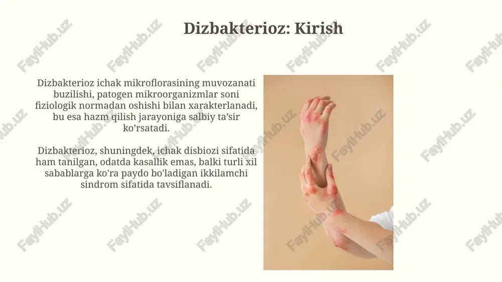 , erkaklarda ayollarga qaraganda tezroq progressiya kuzatiladi, ko'pincha 40 yoshgacha bo'lgan buyrak yetishmovchiligiga olib keladi. prognozga ta'sir etuvchi omillarga genetik mutatsiyaning turi (col4a5, col4a3, col4a4), proteinuriya darajasi va gipertoniya kabi asoratlar kiradi, 50% hollarda eshitish qobiliyatining yo'qolishi kuzatiladi. dermatomiozit: ta'rif va sabablari dermatomiozit - bu teri va mushaklarning surunkali yallig'lanish kasalligi bo'lib, bunda immunitet tizimi organizmning o'z to'qimalariga qarshi antitanalar ishlab chiqaradi. ko'plab hollarda dermatomiozitning aniq sabablari noma'lum, ammo genetik moyillik va virusli infektsiyalar kabi omillar kasallikning rivojlanishiga hissa qo'shishi mumkin. dermatomiozitning belgilari dermatomiozitning asosiy belgilaridan biri terida o'zgarishlar, xususan, ko'z qovoqlarida binafsha rangli toshmalar (heliotrope toshmasi) va qo'llarning bo'g'inlarida gottron papulalari paydo bo'lishidir. muskul zaifligi dermatomiozitning yana bir muhim belgisidir; bu, odatda, tananing ikkala tomoniga ta'sir qiladi va asta-sekin rivojlanib, yelka va son mushaklarida seziladi. dermatomiozitning diagnostik jarayoni dermatomiozit tashxisida qon testlari muhim ahamiyatga ega; kreatin kinaz (ck) va aldolaza kabi mushak fermentlarining darajasi odatda sezilarli darajada oshadi. elektromiografiya …