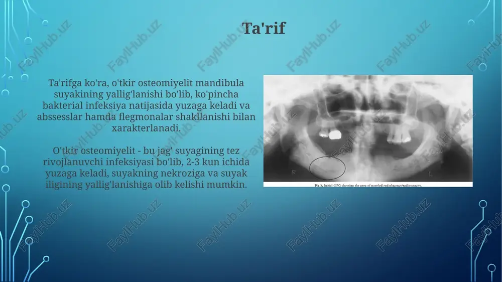 rohlik aralashuvi bilan prognoz odatda qulay bo'lib, suyakning to'liq tiklanishi va funksiyasini tiklash imkoniyati yuqori. kech tashxis qo'yilganda yoki davolashga rioya qilmaslik holatlarida, surunkali osteomiyelitga o'tish xavfi ortadi, bu esa prognozni sezilarli darajada yomonlashtiradi va uzoq muddatli asoratlarga olib kelishi mumkin. profilaktika tish kariyesini erta davolash va og'iz bo'shlig'ining yaxshi gigienasini ta'minlash, og'iz bo'shlig'ida patogen mikroorganizmlar sonini kamaytirish orqali 70% gacha osteomiyelitning oldini olishga yordam beradi. mandibula jarohatlarining oldini olish va ularni 24 soat ichida antiseptiklar bilan to'g'ri davolash, infektsiyaning suyak to'qimalariga tarqalish xavfini kamaytirish orqali osteomiyelitning rivojlanishiga yo'l qo'ymaydi. xulosa mandibula o'tkir osteomieliti, absesslar va flegmonalar bilan birga, erta tashxis qo'yish va agressiv davolash orqali 85-95% hollarda yaxshi prognozga ega bo'lishi mumkin. konservativ va jarrohlik davolashning kombinatsiyasi, jumladan antibiotiklar va drenajlash, 90% hollarda asoratlarni minimallashtirish va to'liq tiklanishga olib kelishi mumkin. e'tiboringiz uchun rahmat image3.jpg image4.jpg image5.jpg image6.jpg image7.jpg image8.jpg image9.jpg image10.jpg image11.jpg image12.jpg image13.jpg image14.jpg image2.png