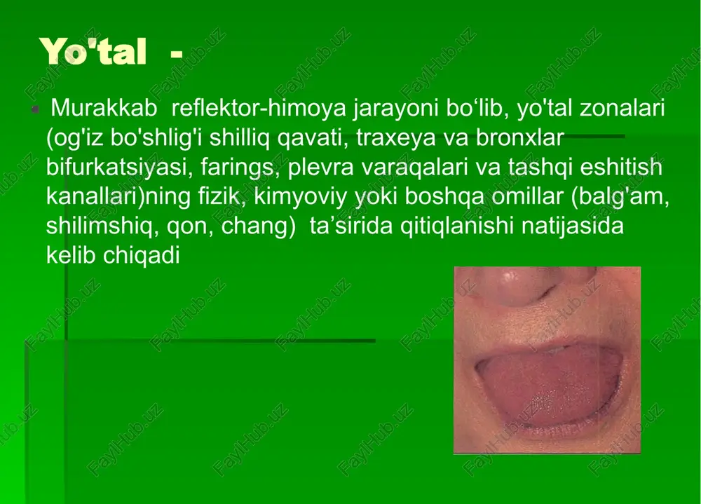 ko'krak qafasidagi og'riq (dolor). bu plevra shikastlanishi bilan (quruq plevrit , plevral bitishmalar, plevral endotelioma) yuzaga keladi. o'pka kasalliklarida (krupoz pnevmoniya, sil kasalligi, o'pka emboliyasi), bunda plevra patologik jarayonga qo'shiladi ko'krak qafasida og'riq (dolor) sanchiqli (quruq plevrit, plevral mezotelioma). ko'krak qafasida og'riq (dolor) tirnovchi va siquvchi (plevrit, gidrotoraks, pnevmotoraks) ko'krak qafasida og'riq (dolor) xanjarsimon (pnevmotoraksning boshlanishi). chuziluvchi (bitishmali, yopishqoq plevrit). ko'krak qafasida og'riq (dolor) o'pka arteriyasi tromboemboliyasining boshida kuchli siquvchi va kuydiruvchi isitma doimiy turi (krupoz pnevmoniya). remittirlovchi va gektik turlari (o'pkaning abstsesi va gangrenasi, sil kasalligi). kam darajadagi (sil, saraton). terlash (sudatio, gipergidrozis) ho'l yostiq simptomi "pichan" hidi bilan sovqotish bilan terlash (abstsess, gangrena). anksioz sindromi (tashvish-qo'rquv). bu saraton kasalligiga va o'pka emboliyasiga xos, patologik jarayonning o'ziga xos aurasi bo'lib, ko'pincha gipoxondriya, saraton kasalligi sifatida qabul qilinadi. umumiy darmonsizlik va ish qobiliyatining pasayishi sil kasalligi - bemorlarning 93%. saraton bemorlarning 92 foizini tashkil qiladi. yiringli kasalliklar - 90% kasallik …