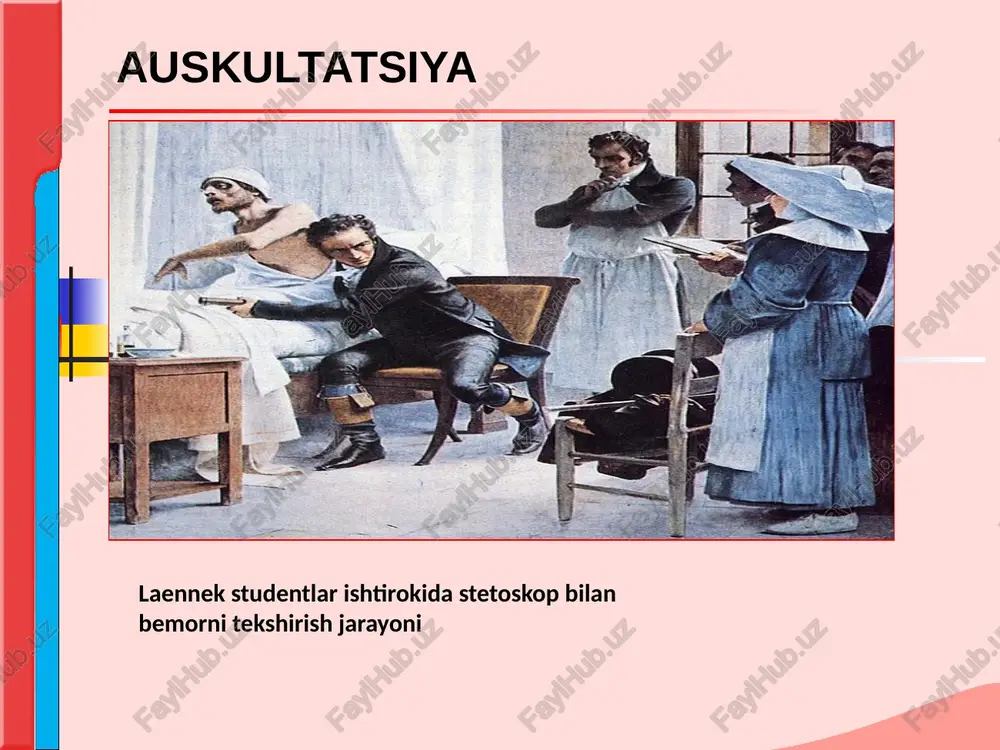 an keyin (protodiastolik ot dupuri ritmi) yoki diastolaning oxirida, 1-ton oldidan ham eshitilishi mumkin (presistolik ot dupuri ritmi) yurak tonlari protodiastolik ot dupuri ritmi yurak mushaklarining kuchli shikastlanish holatlarida uchraydi (og‘ir miokardit, kardioskleroz, gipertonik kasalliklarda va yurakning ishemik kasalliklarida). 3-tonning diastola boshida hosil bo‘lishi bo‘shashgan yurak mushaklarining qon tushganida cho‘zilib ketishi natijasidir. bu ton 2-tondan 0,12–0,2 sek. keyin hosil bo‘lib, uni fiziologik 3-tonning kuchayishi deb atasa ham bo‘ladi. presistolik ot dupuri ritmi bo‘lmachaning kuchli qisqarishi va qorinchalar tonusining pasayishi bilan bog‘liq. atrioventrikulyar o‘tkazuvchanlikning susayishida yaxshiroq aniqlanadi. fiziologik 4-tonning kuchayishini aks ettiradi. mezodiastolik (qo‘shilgan) ot dupuri ritmi – taxikardiya va miokard juda susayganda har ikkala ton kuchayadi va diastola o‘rtasida qo‘shilib ketadi. bu salbiy diagnostik ahamiyatga ega yurak tonlarini eshitish yurak tonlarini eshitish normaldir va bu jarayon bir tartibda, ma'lum nuqtalarda amalga oshiriladi: yurak klapanlarining ishlashini baholash uchun birinchi, ikkinchi, uchinchi va to'rtinchi tonlar eshitiladi. buning uchun stetoskop yordamida birinchi tonni …