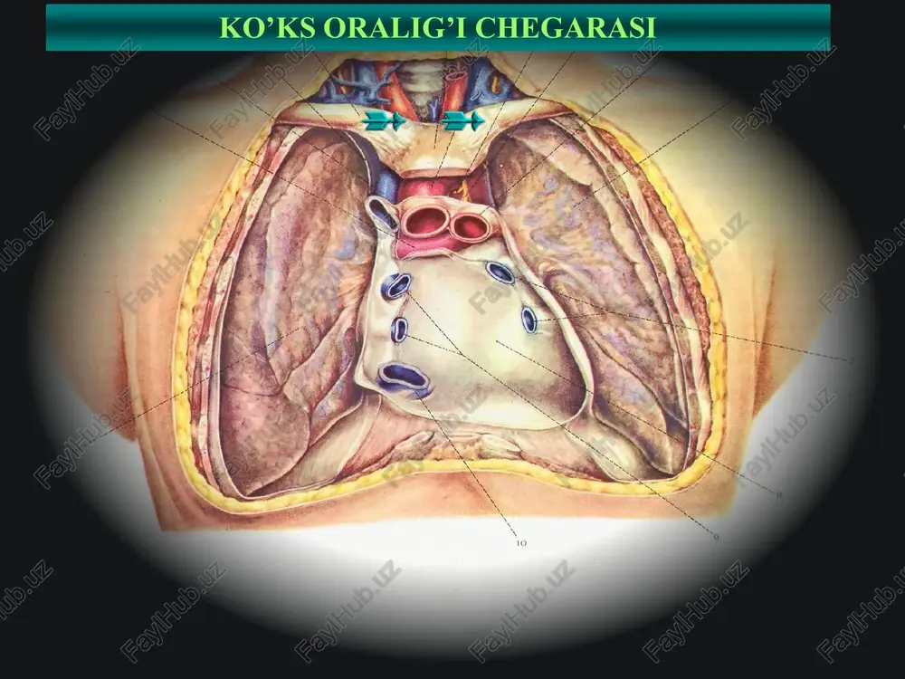 qori kovak vena 19 surunkali mediastinitni davolash • konservativ terapiya – tuberkulezga qarshi terapiya, aktinolizatlar va antibiotiklar bilan aktinomikozni davolash, nurli terapiya, kortikosteroidlar • • jarohlik davo – mediastinal limfatik tugunlarni olib tashlash, kompressiyani keltirib chiqargan bitishmalar va chandiqlarni bartaraf etish • 20 • ko‘ks oralig‘ida o‘sma kasallik-larining 100 taga yaqin turlari uchraydi. • ko‘ks oralig‘i chin o‘sma kasalliklari embriogenetik ko‘ks oralig‘iga xos bo‘lgan to‘qimalardangina hosil bo‘ladi yoki abberatsiya natijasida shu to‘qimalarga xos bo‘lib rivojlanadi. • ko‘ks oralig‘ida uchraydigan o‘sma kasalliklar onkologik kasalliklar ichida 1%ni tashkil qiladi. • havfli va havfsiz o‘smalar 4:1 nisbatda uchraydi • ko‘ks oralig‘i o‘sma kasalliklari ko‘proq yosh va o‘rta yoshli aholida uchrab, erkaklar va ayollar birhilda zararlanadi. • 21 ko’ks oralig’i o’smalari barcha xavfli o’smalarni 3-7%ini tashkil qiladi; barcha o’smalarni 3%ini tashkil qiladi; henning a. gaissert va douglas mathisen (2001y) 23 o’rta qism-20% pastki qism-26% oldingi yuqori bo’lim-54% ko‘ks oralig‘i kistalarini lokalizatsiyasi • yuqori – …