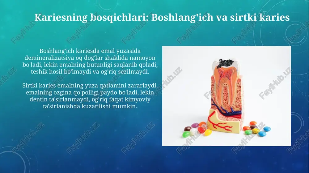 karies bosqichlari - Page 3