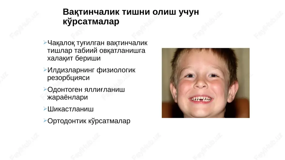 h vaqtinchalik tish to'liq dislokatsiyadan keyin vaqtinchalik tishlar qayta tiklanmaydi ortodontik davolanish tish tishining deformatsiyasini oldini olish uchun ko'rsatiladi 17 vaqtinchalik tishni olish uchun ko'rsatmalar tish sinishi bachadon bo'yni darajasida tish tojining sinishi tish tojining sinishi, agar ildiz rezorbsiya bosqichida bo'lsa vaqtinchalik tish ildizining shikastlanishining barcha turlari 18 vaqtinchalik tishni olish uchun ko'rsatmalar jag sinishi jag' sinishlarida siniq chizig'idagi tish olish uchun ko'rsatma 19 vaqtinchalik tishni olish uchun ko'rsatmalar ortodontik ko'rsatmalar sut tishi doimiy tish chiqishiga xalaqt berayotgan bo'lsa yoki doimiy tish chiqib bo'lgan vaqtda ham sut tishi turgan bo'lsa 20 vaqtinchalik tishni olish uchun ko'rsatmalar odontogen yallig'lanish jarayonlari shikastlanish ortodontik ko'rsatmalar ko'p sonli va to'rli tishlar 21 vaqtinchalik tishni olish uchun ko'rsatmalar surunkali granulyat yoki granulomatoz periodontit o'tkir yiringli periostit (ko'rsatmalarga ko'ra) o'tkir va surunkali odontogen osteomielit odontogen xo'ppozlar va flegmonalar tishning toj qismini sezilarli darajada vayron qilish, agar ikkinchisining ildizidan foydalanib bo'lmasa protezlash tish davolash bilan bog'liq asoratlar …