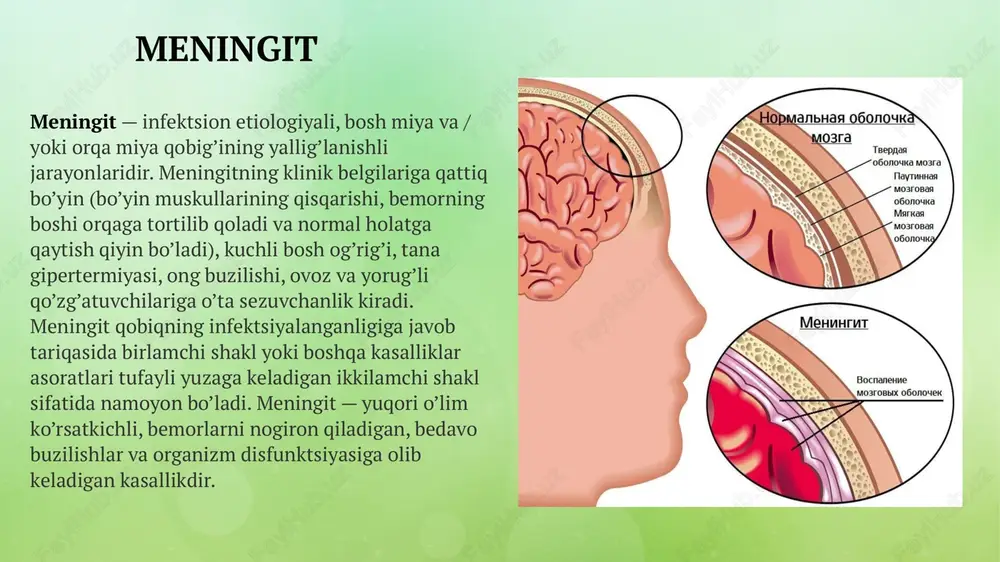siyaning homilaga amniotik suyuqlik orqali yuqishi; og’zaki: meningit qo’zg’atuvchilari bilan ifloslangan suvni yutish (suv omborlarida, dezinfektsiya qilinmaydigan jamoat basseynlarida tasodifan yutish, ifloslangan suv ichish) va hokazo. kattalardagi meningit kasallanish xavfi mavjud guruh 20 dan 30 yoshgacha bo’lgan yosh erkaklardan iborat. eng ko’p kuzatiladigan patogenlar meningokokklar, pnevmokokklar, gemofil tayoqchalaridir, shuningdek, tuberkulyoz kasalligini noto’g’ri davolash fonida meningitning tuberkulyoz shakli ham uchraydi. ushbu yoshda miya qobiqlari yallig’lanishining keng tarqalgan sabablaridan biri tibbiy madaniyatning yetishmasligidir: turli xil kasalliklarga (karioz jarayonlar, gaymorit, otit, bronxit, respirator virusli infektsion kasalliklar) jiddiy e’tibor qaratmaslik va to’liq davolanmaslik. ayollar meningitga kamroq moyil bo’lishadi, lekin homiladorlik davrida immunitetning tabiiy pasayishi tufayli kasallik rivojlanishi xavfi oshadi. profilaktik tadbirlarga oldindan emlash, o’z vaqtida sanatsiya qilish, yallig’lanishli kasalliklarini davolash, aloqalarni cheklashlar kiradi. 9 bolalarda meningit tug’ilgandan boshlab 5 yoshgacha bo’lgan davrda meningit bolalar uchun o’ta jiddiy xavf hisoblanadi, o’lim darajasi juda yuqori: har 20 nafar bemor boladan bittasi kasallik tufayli vafot etadi. ushbu …