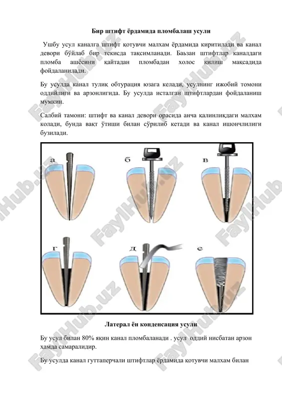 ildiz kanallarini plombalash usullari - Page 4