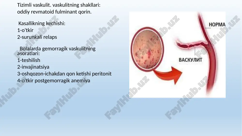 aniqlashda nefritning borishi haqida bashorat qilish, shuningdek davolash jarayonini nazorat qilish imkonini beradi. buyrak biopsiyasiga ko'rsatma davolashdan oldin yo'qolmaydigan glomerulonefrit belgilarining doimiy namoyon bo'lishi mumkin. gemorragik vaskulitni davolash bolalar: gemorragik vaskulit bilan og'rigan bolani davolash shifoxona sharoitida amalga oshiriladi. keyin u klinikada tekshiriladi va uyda kuzatiladi. kasalxonada davolanish muddati 3 haftadan 6 haftagacha. bolada kamida 3 hafta davomida yotoqda dam olishni kuzatish kerak, keyin u asta-sekin kengaytirilib, bolaning vaqti-vaqti bilan turishiga imkon beradi. kompleks davolash qat'iy dietani o'z ichiga oladi. bolalar uchun quyidagi mahsulotlar taqiqlanadi: kofe kakao va uni o'z ichiga olgan mahsulotlar shokolad (qora va sut) tsitrus mevalari yangi rezavorlar o'z ichiga olgan ovqatlardan foydalanishni cheklang: hayvon oqsillarining ekstraktiv moddalari ko'p miqdorda gistaminsiz bunday dorilarni davolash uchun foydalana olmaysiz:sulfanilamidlar antibiotiklar askorbin kislotasi kaltsiy preparatlari bolalardagi gemorragik vaskulitni davolashning asosi geparin terapiyasi hisoblanadi. geparin bolalarga 300-400 birlik / kg dozada avtokoagulyatsion test nazorati ostida buyuriladi. shuningdek, tizimli davolash qon tomir …