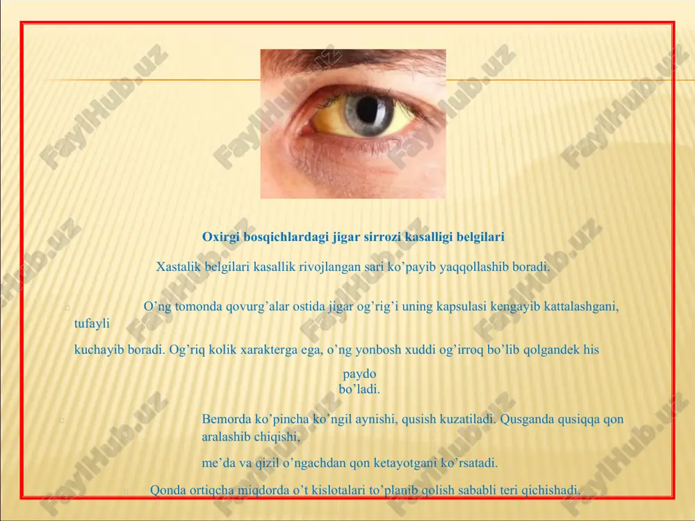 kshiruvlar (echtning oshishi, leyko- va trombotsitopeniya, gipergammaglobulinemiya, alt va astning, bilirubinning oshishi, disproteinemiya) jigar bioptatini gistologik tekshirish natijalari o’tkir gepatit birlamchi biliar sirroz uilson-konovalov kasalligi birlamchi sklerozlovchi xolangit qo’zish davrida gospitalizatsiya qilish 5-dieta stoli – qovurilgan, o’tkir oziqlarni kiritmaslik spazmalitiklar – noshpa, platifillin gepatoprotektorlar – essensiale, karsil, vitaminlar profilaktikasi - virusli o’tkir gepatitning oldini olish, alkogol iste'moliga chek qo’yish, o’tkir gepatitni sifatli davolash, turmushda va ishlab chiqarishda zaharlanishga barham berish. oqibati - kasallikning bosqichiga, protsess faolligining gistologik belgilariga, nekrozning tipiga bog’liq. butunlay sog’ayish juda kam. 10-25% bemorlarda spontan remissiya 30-50% bemorlarda jigar sirroziga o’tish kuzatiladi jigar-hujayra karsinomasi malignizatsiya image1.jpeg image2.png image3.png image5.jpg image6.jpg image7.png image8.png image9.png image10.jpeg image11.png image12.jpeg image13.png image14.jpeg image15.png image16.png image17.png image18.png image19.png image20.png image21.png
