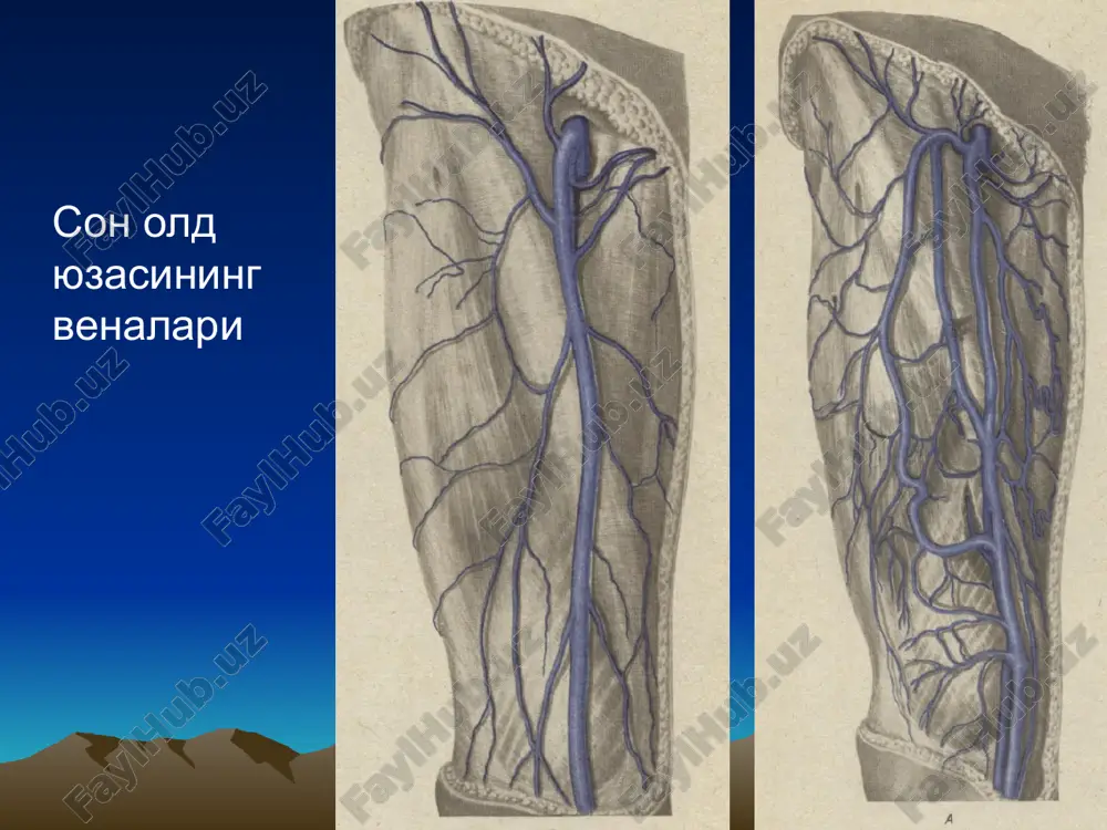 vazin, venoruton, indometatsin); nomaxsus yalliglanishga karshi vositalar (reopirin, butadion); desensibilizatsiyalovchi vositalar (diazolin, dimedrol, suprastin); geparin malxamini maxalliy kullash. davosi: (davomi) oyokni elastik bint bilan urash; ma'lum masofaga yurish; jarayon son teri osti venasiga tarkalganda tez muddatlarda troyanov-trendelenburg operatsiyasini bajarish lozim. girke buyicha emboliyalar chizmasi. vena tizimidagi tromb upka emboliyasiga olib keladi. yurak ikki tabakali klapanining trombi (miya, son arteriyali, buyrak, kora talok va boshka a'zolarning emboliyasini keltirib chikaradi. oval teshik orkali utgan uzuk-uzuk chizik paradoksal emboliya yulini bildiradi. oyok chukur venalarining utkir trombozlari flebotrombozlar. tromboflebitlar. flebotrombozlar flebotrombozda tromb deyarli soglom vena devorida shakllanib, vena devoriga deyarli urnashmagan buladi. ok ogrikli flegmaziya (phlegmasia alba dolens) va kuk flegmaziya (phlegmasia coerulea dolens) farklanadi. oldini olish (maxsus) kon reologik xusisiyatlarini xamda mikrotsirkulyatsiyani yaxshilovchi vositalar (reopoliglyukin, komplamin); trombotsitlarning adgeziv-agregatsion faoliyatini yaxshilovchi vositalar (trental, kurantil); konning koagulyatsiya kuvvatini kamaytiruvchi vositalar (geparin kichik dozalarda, bilvosita ta'sir kursatuvchi antikoagulyantlar). oldini olish (nomaxsus) oyokni elastik bint bilan urash; …