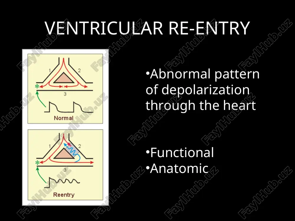 g to focus on classes i and iii because these are the ones affecting the action potential directly so they will be most useful in these re-entry circuits * how these drugs affect re-entry class i: retards conduction enough so that beat still gets through normal cardiac tissue but not through any weakened tissue class iii: prolongs refractoriness the class i drugs can completely block conduction through the weakened tissue. since the weakened tissue isn’t going to block an entire pathway through the hear, just enough of one to cause some mischief, the wavefront will still be able to propogate in the surrounding normal tissue the class iii drugs prolong repolarization so the re-entry circuit will still begin to develop, but since only one side will have the issue, when the wave has circled all the way back around the cells that are slowed down still will not have recovered, …