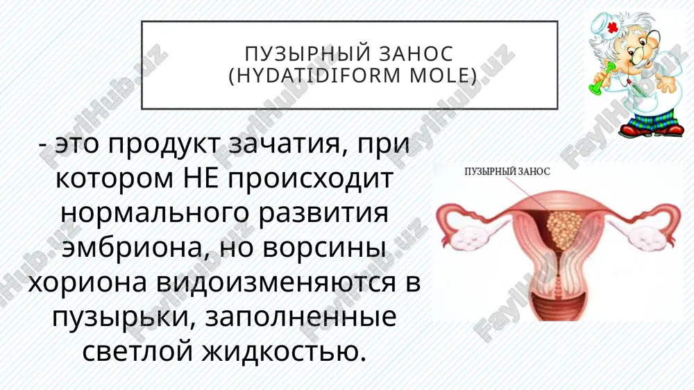 gestatsionnaya trofoblasticheskaya bolezn - Page 4