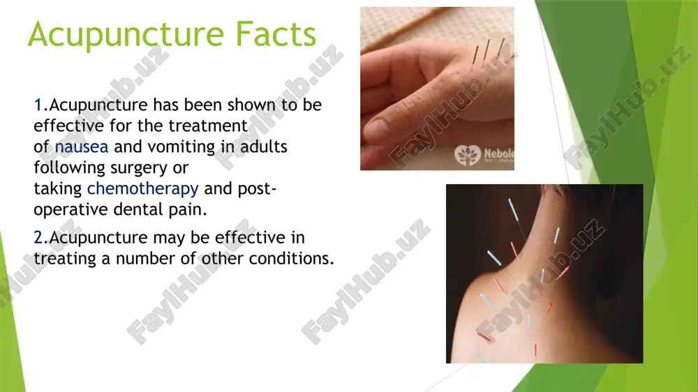 acupuncture - Page 4