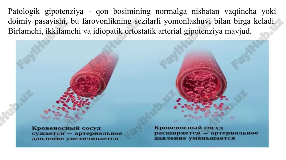 arterial gipotenziya - Page 4