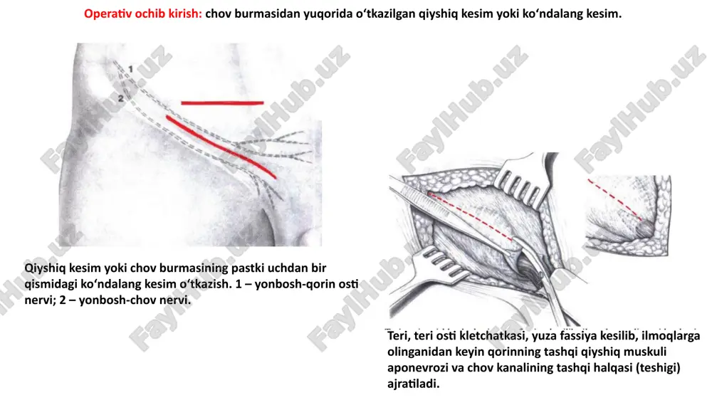 tilgan usullar a-jirar usuli b-martinov usuli c-spasokukotskiy usuli d-kimbarovskiy-spasokukotskiy orqa devorini mustahkamlash usullari e-bassini f-krimov image1.png image2.png image3.png image4.png image5.png image6.png image7.png image8.png image9.png image10.png image11.png image12.png image13.png image14.png image15.png image16.png image17.png image18.png image19.png image20.png image21.png image22.png image23.png image24.png /docprops/thumbnail.jpeg