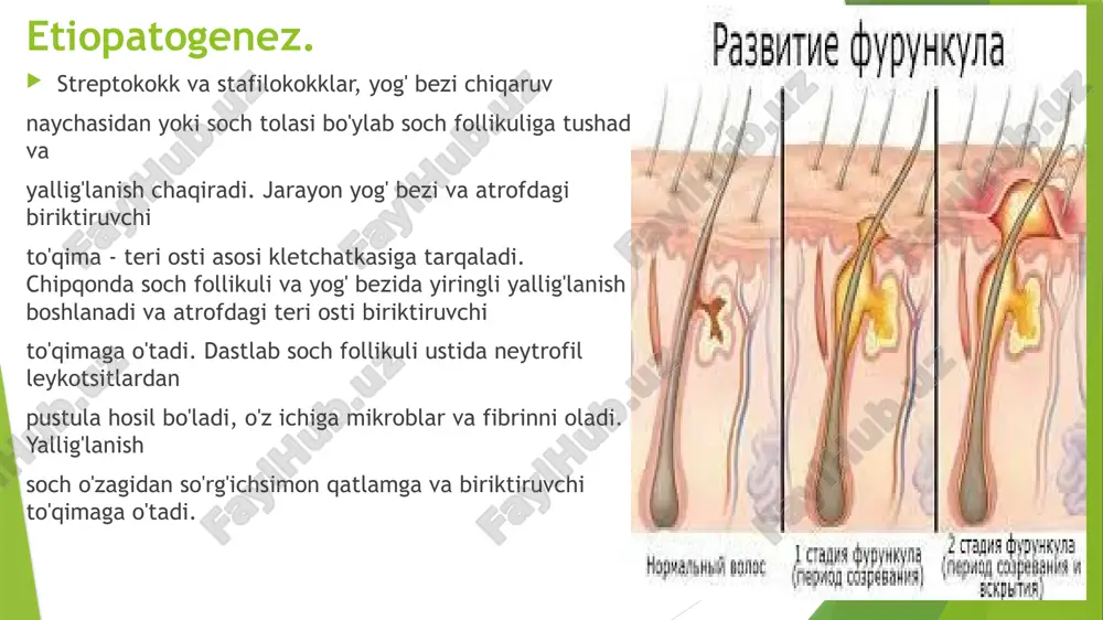 ida bo'lgan hollarda qattiq-quruq ovqat bilan cheklaniladi, ko'p gaplashish man etiladi.asosiy usul: jarrohlik yo’li asoratlari; tromboflebit va limfangit, tromboz, sepsis, yiringli meningitni limfadenitlar limfadenit — bu limfa tugunlarining spetsifik yoki nospetsifik yallig’lanishi o’tkir: seroz va yiringli surunkali: giperplastik va surunkali limfadenit o’tkirlashuvi etiologiya: patogen (piogen) mikroflora — streptokokklar va stafilokokklar va ular ishlab chiqaradigan toksinlar o’choqdan limfogen yo’l yoki qon oqimi bilan migratsiya qiladi. shuningdek infektsion agentlar limfa tomirlariga jarohatlangan teri yoki shilliq qavatlar orqali kirishi mumkin (kontaktli yo’li). o’tkir limfadenit klinikasi: boshni harakatlantirganda noqulaylik, kattalashgan limfatik tugunlar, paypaslaganda og’riq va zich elastik konsistensiya; jarayon yiringlashga o’tganda: tugun sohasida infiltrat,tugunlar bir-biri bilan qo’shilib tugun hosil qilib yiringlaydi, tana harorati 37,2-37,8 c xolsizlik, injiqlik, ishtaha buzilishi 21 o’tkir limfadenit klinikasi: bemor og’riq sindromi kuchayishini qo’zg’atmaslik uchun tananing muayyan qismlarida harakatni cheklashga majbur bo’ladi. yiringli erishda flyuktuatsiya kabi belgi paydo bo’ladi (yallig’lanish hududi palpatsiyasida suyuqlikning siljishi). adenoflegmona shakllanishli yiringli kapsulaning yorilishi alohida …