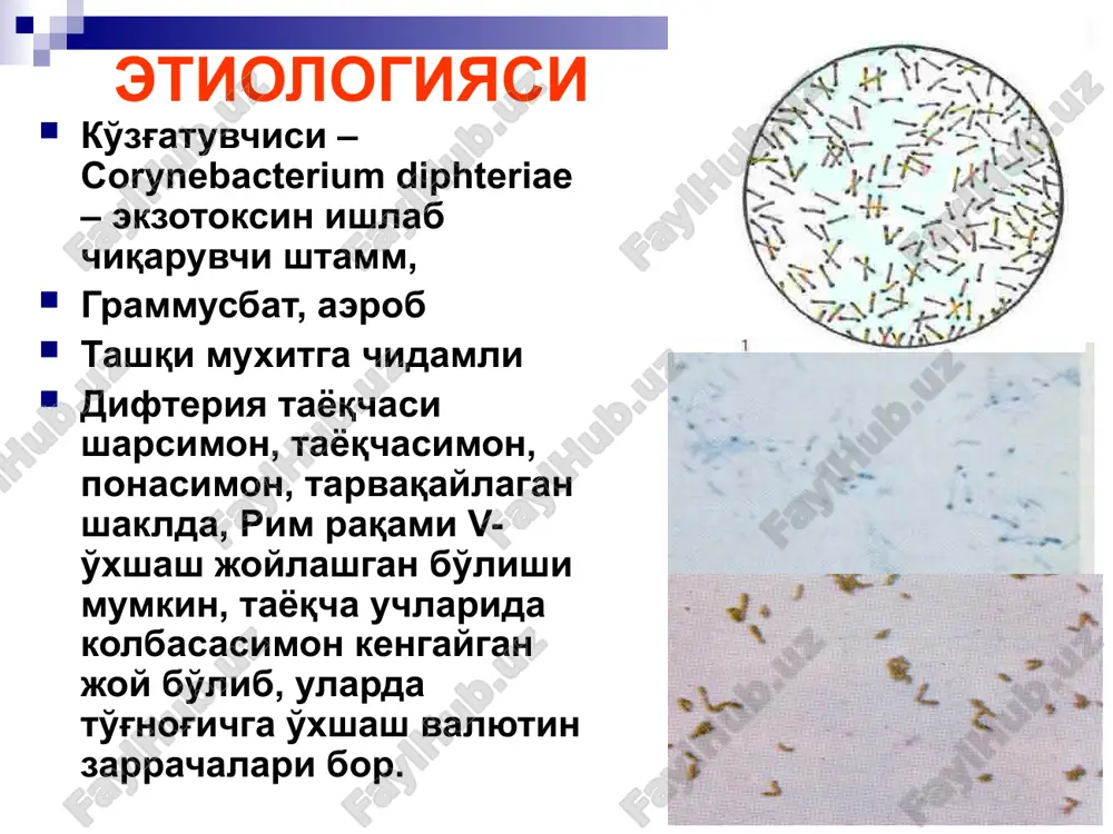 li jarohatlanish xarakteriga qarab: pardali, orolchasimon, kataral turlari farqlanadi. tomoq difteriyasi o'choqli shaklining pardali shaklda kechishi: tipik kechishiga misol bo'ladi. bunda difteriya pardasi bodom bezi yuzasini butunlay qoplab olgan bo'ladi. difteriya pardasi ravon, kulrang-perlomutr rangda yaltiroq ko'rinadi. difteriya pardasini ko'chirib olish juda qiyin bo'ladi va ko'chirib olgandan keyin bodom bezi to'qimasi qonaydi. difteriya pardasi buyum oynachasi ustiga qo'yib shpatel bilan ezilsa ezilmaydi. tomoq difteriyasi o'choqli shaklining orolchasimon shaklda kechishi: bodom bezi ustidagi difteriya pardasi har xil kattalikda, orolcha shaklida joylashgan bo'ladi. bemorning tana harorati subfebril darajada bo'ladi, umumiy ahvoli aytarlik yomon bo'lmaydi. tomoq difteriyasi o'choqli shaklining kataral shaklda kechishi: bu shaklda kechishi atipik kechishiga misol bo'ladi. chunki kataral shaklida difteriyaga xos bo'lgan eng asosiy klassik belgi – difteriya pardasi bo'lmaydi. asosiy klinik belgisi esa bodom bezlarining biroz shishib, giperemiyalanishi kuzatiladi. bemor yutinganda tomog'ida biroz noqulaylik sezadi. isitma kuzatilmaydi, intoksikatsion belgilar namoyon bo'lmaydi. tomoq difteriyasi difteriyaning o'choqli shakli pardali shakli – …