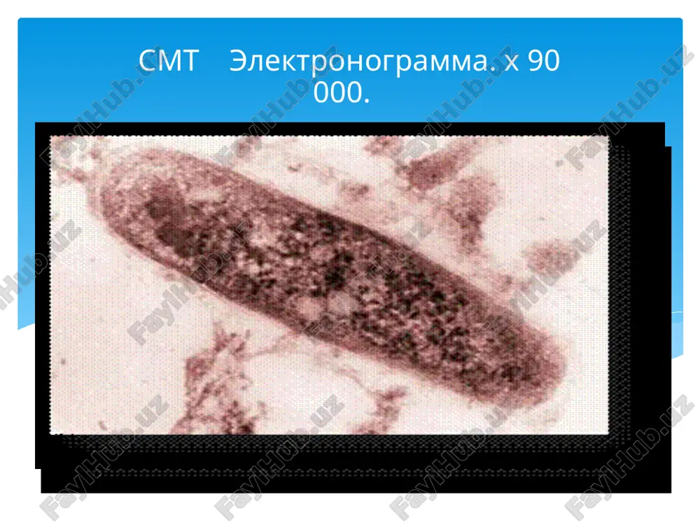 i. silda allergiya “allergiya” so'zi grekchadan olingan bo'lib boshqacha ta'sir, boshqacha javob reaktsiyasm ma'nosini anglatadi.bu tushnchani ilk bora fanga klement pirke olib kirganu bu fenomeni qaytadan yuborilgan moddaga nisbatan organizm sezgirligini o'zgarishi deb xisoblagan. sildagi allergik reaktsiya immunitetning bir ko'rinishi deb hisoblanadi.allergik reaktsiya xujayraviy va gumoral immunitet bilan bog'liq. sildagi alergiya asta sekin rivojlanadigan va uziga xosligi bilan ajralib turadi. ma'lumki tuberkulin sil mikobakteriyalarining hayot mahsuloti bo'lib sensibilizatsiyaga uchragan organizmda javob reaktsiyasini chiqaradi. bunda immunaziyalashgan makrofag tarkibidagi teri reaktiv omiliga bog'liqligi aniqlanadi. silda yallig'lanish asosida 3 xil to'qima reaktsiyasi yotadi: 1. alteratsiya (nekroz) 2.ekssudatsiya 3.proliferatsiya silda spetsifik o'zgarishlar asosan produktiv asosan ekssudativ asosan nekrotik yoki suzmasimon produktiv reaktsiya tarqalgan sil nekrotik tipdagi reaktsiyalar kazeoz pnevmoniya ikkilamchi sil fibroz- kavernoz sil. e'tiboringiz uchun raxmat image2.png image3.png image4.jpeg image5.jpeg image6.jpeg image7.jpeg image11.jpeg image17.jpeg image18.jpeg image19.jpeg image20.png image21.jpeg image22.jpeg image23.png image24.jpeg image25.jpeg image26.jpeg image27.jpeg image28.jpeg image29.png image30.jpeg image31.jpeg image32.jpeg image33.png image34.jpeg image35.png image36.png …