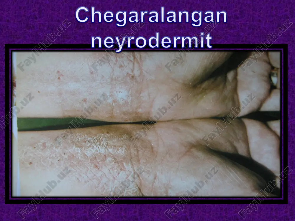 neyrodermatozlar - Page 4