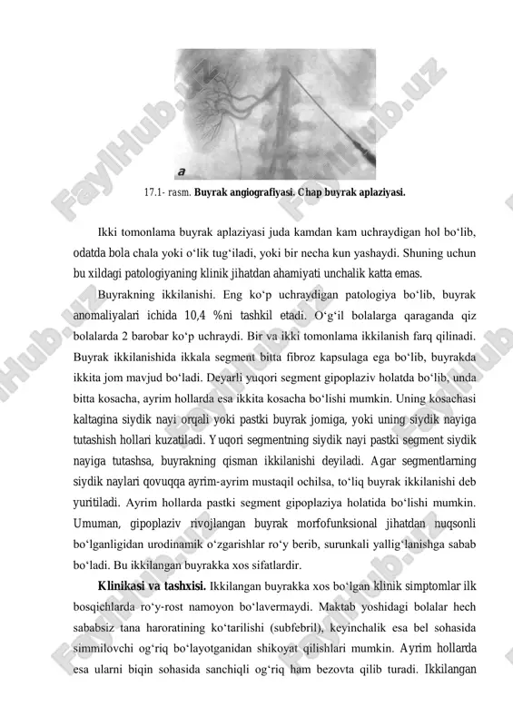 svirda buyraklarning to‘liq yoki noto‘liq ikkilanganligini aniqlash mumkin. siydikning solishtirma og‘irligi kam bo‘lgan holatlarda infuzion urografiyadan qo‘llaniladi. yanada aniq tashxis qo‘yish uchun diagnostik sistoureteroskopiya qilish lozim. bu tekshirish usuli orqali siydik naylari teshiklari topiladi va ureteral stent qo‘yib tekshirishni retrograd ureterografiya bilan to‘ldirish mumkin. 17.3-rasm. retrograd pielogramma. ikki tomonlama buyraklar to‘liq ikkilanishi. davosi. hech qanaqa klinik belgilar bo‘lmaganda hech qanday muolaja talab qilinmaydi. agar ikkilangan qismning birida gidronefroz, pielonefrit, buyrak-tosh kasalligi qo‘shilgan bo‘lsa, shu kasalliklarga xos davo o‘tkaziladi. agar ikkilangan buyrakni olib tashlash talab qilinadigan patologiya bo‘lsa, geminefrektomiya - o‘sha patologik jarayonga uchragan ikkilangan buyrakdan biri olib tashlanadi, agar ikkalasi ham kuchli zararlangan bo‘lsa, u paytda nefrektomiya bajariladi. operatsiyadan keyingi davrda regional limfa terapiyasini qo‘llash maqsadga muvofiqdir. bu usul yaxshi natija beradi va antibiotiklarni tejash imkonini yaratadi. bu terapiyani qo‘llash uchun operatsiya paytida buyrak jomining orqa tomonida mikroirrigator qoldiriladi. bemorlar operatsiyadan keyin 2-3 yil davomida dispanser kuzatuvida bo‘lishlari lozim. qo‘shimcha …