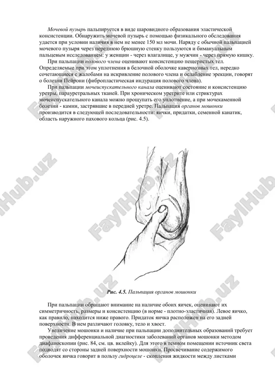 lyaemie pri etom uplotneniya v belochnoy obolochke kavernoznix tel, neredko sochetayushiesya s jalobami na iskrivlenie polovogo chlena i oslablenie erektsii, govoryat o bolezni peyroni (fibroplasticheskaya induratsiya polovogo chlena). pri palpatsii mocheispuskatelnogo kanala otsenivayut sostoyanie i konsistentsiyu uretri, parauretralnix tkaney. pri xronicheskom uretrite ili strikturax mocheispuskatelnogo kanala mojno proshupat ego uplotnenie, a pri mochekamennoy bolezni - kamni, zastryavshie v peredney uretre. palpatsiya organov moshonki proizvoditsya v sleduyushey posledovatelnosti: yaichki, pridatki, semennoy kanatik, oblast narujnogo paxovogo koltsa (ris. 4.5). ris. 4.5. palpatsiya organov moshonki pri palpatsii obrashayut vnimanie na nalichie oboix yaichek, otsenivayut ix simmetrichnost, razmeri i konsistentsiyu (v norme - plotno-elastichnaya). levoe yaichko, kak pravilo, naxoditsya nije pravogo. pridatok yaichka raspolojen na ego zadney poverxnosti. v nem razlichayut golovku, telo i xvost. uvelichenie moshonki i nalichie pri palpatsii dopolnitelnix obrazovaniy trebuet provedeniya differentsialnoy diagnostiki zabolevaniy organov moshonki metodom diafanoskopii (ris. 84, sm. tsv. vkleyku). dlya etogo v temnom pomeshenii istochnik sveta …