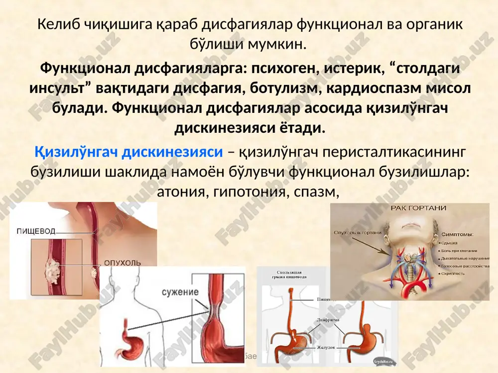 iq qismini egallagan zararlanish diagnoz gerk diagnozi xos simptomlar: kekirishlar (regurgitatsiyalar) mavjudligida qo'yiladi: ayrim hollarda qizilo'ngachdan tashqari simptomlar kuzatiladi: bronx-o'pka simptomlari – yo'tal, bo'g'ilish; otorinolaringologik – ovoz o'zgarishi, faringit simptomlari stomatologik – karies, tish emali eroziyalari proton pompasi ingibitori bilan test jig'ildon qaynashini proton pompasi ingibitori qabul qilish fonida bartaraf qilish. gerkda tashxisini qo'yish uchun kerakli bo'lgan sezuvchanlik va spetsifiklikka ega. qushimcha laborator va instrumental metodlar sutkalik qizilo'ngach rn- metriyasi : reflyuks umumiy vaqtining kattalashuvi (rn 4,0dan kamroq, sutka davomida 5% dan ko'proq) va reflyuks epizodining uzunligi (5 min dan ko'p). metod qizilo'ngach va oshqozonda rn holatini, dorilarning samaradorligini aniqlashga yordam beradi. qizilo'ngachdan tashqari simptomlar mavjud vaqtda foydali bo'lishi mumkin qushimcha laborator va instrumental metodlar qizilo'ngach manometriyasi –qizilo'ngach pastki sfinkteri funktsiyasini va qizilo'ngachning motorik funtsiyasini aniqlashda ishlatiladi qorin bo'shlig'i a'zolari uzi si –gerk da o'zgarishlarsiz, qorin bo'shlig'i a'zolari qo'shimcha kasalliklarini aniqlash uchun. ekg, veloergometriya – yuik bilan dif.diagnostika jarayonida ishlatiladi. …