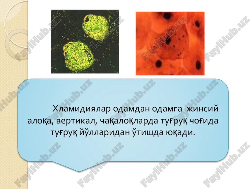 yordam bermaganda, geonatal gerpesi bor chaqaloqlarni tekshirish kerak. vpg-1 va vpg-2 alohida tekshirish kerak. jinsiy a'zolarda pufakcha, toshma, qichishish, achishish , igm va igg titri musbat bo'lsa , hisobga olish va terapiya o'tkazishga asos bo'ladi. tug'ruqdan oldin ayolda gerpetik urogenital infektsiya bo'lishi sababli bolani zararlanishdan saqlash maqsadida kesarevo operatsiyasi o'tkaziladi. e'tiboringiz uchun raxmat