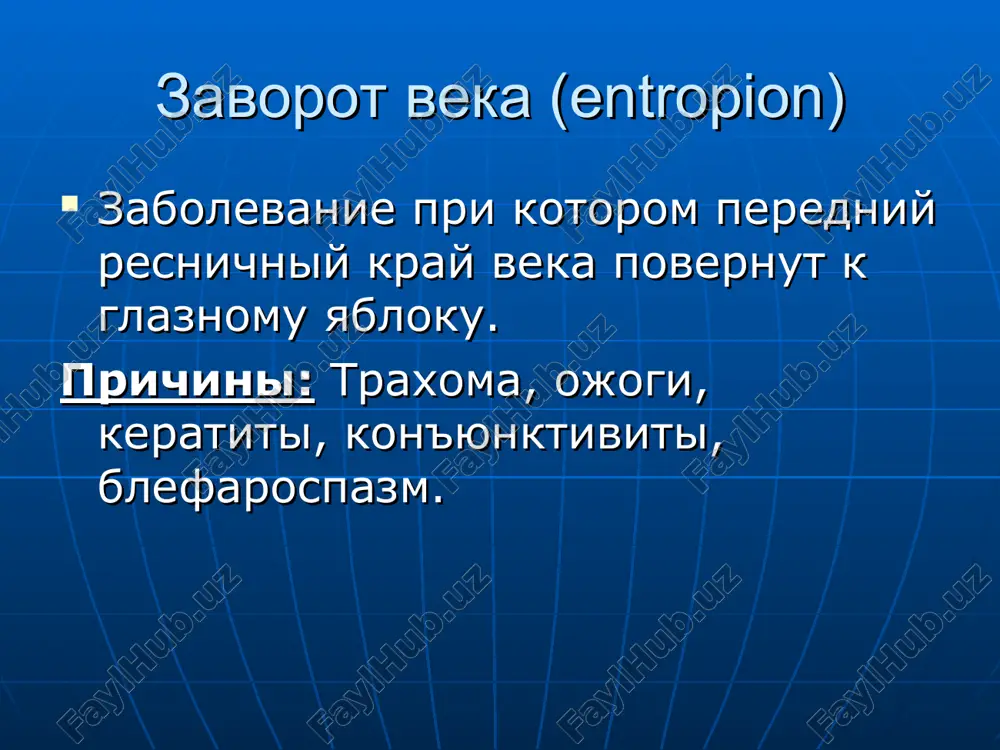 altsev etiologiya: posle ekstirpatsii sleznogo meshka pri traxome pri tuberkuleznoy ili sifiliticheskoy infektsii kanaltsev pri nalichii v nix inorodnix tel gnoynoe vospalenie kanaltsev klinika: koja v oblasti kanaltsa pripuxaet, stanovitsya giperimirovannoy. pri dotragivanii boleznenno gnoynoe otdelyaemoe kanalets palpiruetsya v vide plotnogo shnura sujenie i obliteratsiya sleznix tochek prichina – xronicheskie kon'yunktiviti i blefariti. klinika: sglajivaetsya, prituplyaetsya zadnee rebro vek, proisxodit rubtsevanie tkaney v okrujnosti sleznoy tochki. inogda sujenie sleznix tochek obuslovleno stoykim spazmom m. sphincter puncti lacrimalis operatsii na sleznix kanaltsax perevyazka sleznix kanaltsev rassheplenie sleznix kanaltsev operatsiya aktivizatsii verxnego sleznogo kanaltsa po erlishevu xirurgicheskoe lechenie obliteratsii sleznix kanaltsev: po kolinu po djonsu po moraksu-valeru-viale operatsii na sleznix tochkax uvelichenie nijney sleznoy tochki: po arltu po titovu operatsii pri dislokatsii nijney sleznoy tochki. operatsii pri vivorote nijney sleznoy tochki: po blashkovichu po tixomirovu po poxisovu operatsiya po li v modifikatsii kallaxana po shartsu po alekseevu operatsii pri atrezii sleznix tochek …