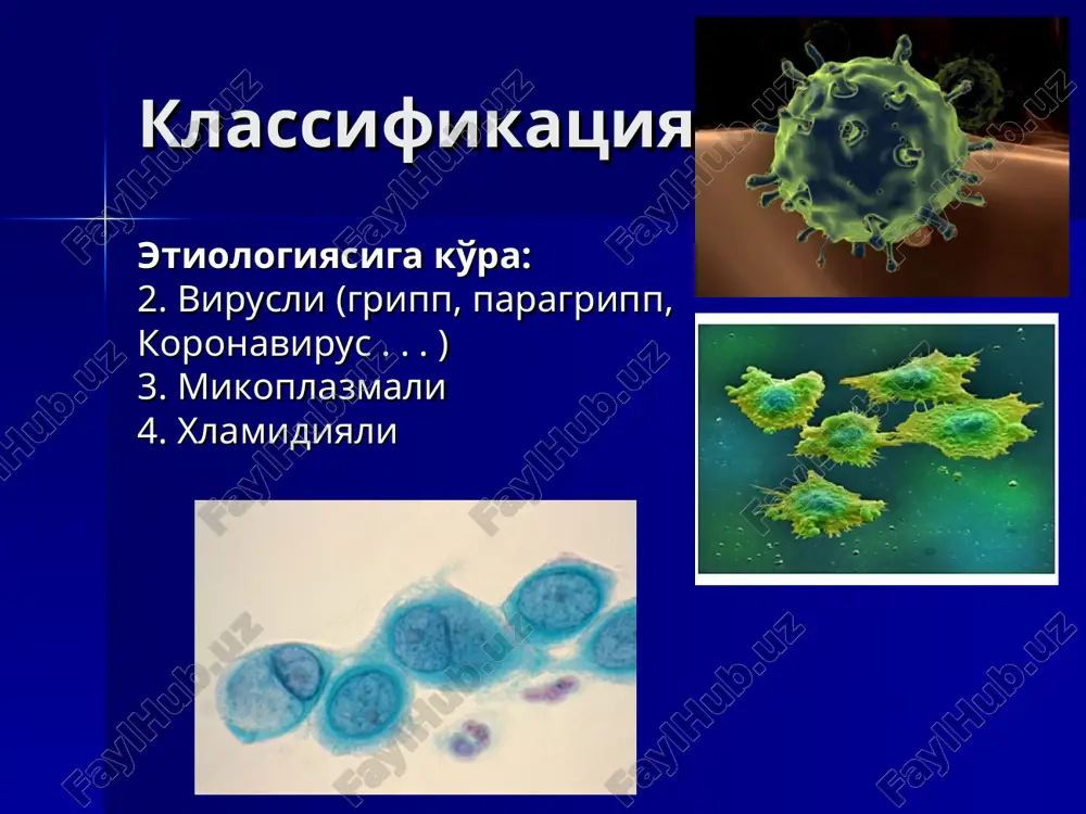 ri ko'proq pastki bo'laklar, o'ng o'pka o'rta bo'lagi va kam hollarda yuqori bo'lak zararlanadi. zaralangan tomonda ildiz kengaygan, ekssudativ plevrit aniqlanishi mumkin. diagnostika rentgenologik tekshiruv diagnostika rentgenologik tekshiruv diagnostika rentgenologik tekshiruv diagnostika rentgenologik tekshiruv diagnostika rentgenologik tekshiruv diagnostika ko'krak qafasini ultratovush bilan tekshirish plevra bo'shlig'ida hatto juda kam miqdordagi suyuqlikni ham aniqlashga imkon beradi (10 ml). kt o'sma va boshqa kasalliklar bilan qiyosiy tashxislash uchun o'tkaziladi. diagnostika diagnostika o'ng o'pka o'rta bo'lagi pnevmoniyasi davolash kasalxonadan tashqari pnevmonii ambulator: i kategoriya – antibiotikoterapiya per os: amoksitsillin yoki makrolid (azitromitsin, eritromitsin). alternativ vositalar: respirator ftorxinolonlar (levofloksatsin, moksifloksatsin), doksitsiklin ii kategoriya - antibiotikoterapiya per os: himoyalangan aminopenitsillin (amoksitsillin + klavulon kislota) yoki tsefalosporin ii avlodi (tsefuroksim) alternativ vositalar: ftorxinolonlar iii-iv avlod (levofloksatsin, moksifloksatsin) yoki parenteral tsefalosporin iii avlod (tseftriakson) davolash statsionar: iii kategoriya – v/i himoyalangan amino-penitsillin (amoksitsillin + klavulon kislota) ili tsefalosporin ii-iii avlod (tsefuroksim) alternativ vosita – makrolid (azitromitsin) yoki ftorxinolon …
