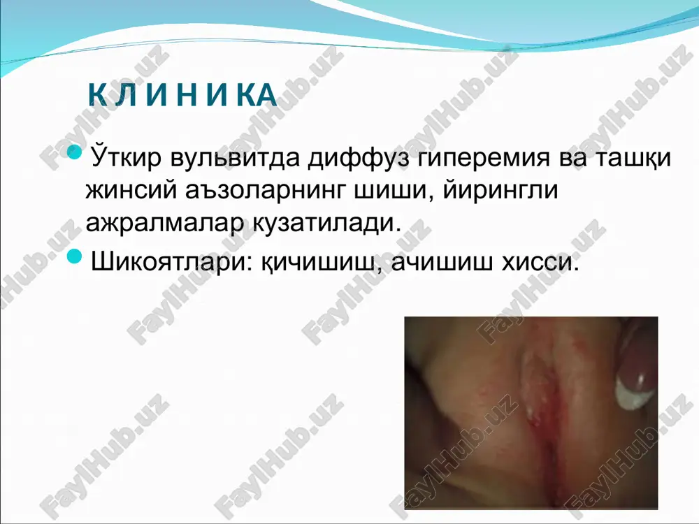 atorlar (pirogenal,tsikloferon); - biostimulyatorlar (lidaza); - iglorefleksoterapiyu, psixoterapiyu fizioterapiya- vibratsion ginekologik massaj, elektroforez davolash etiboringiz uchun raxmat!