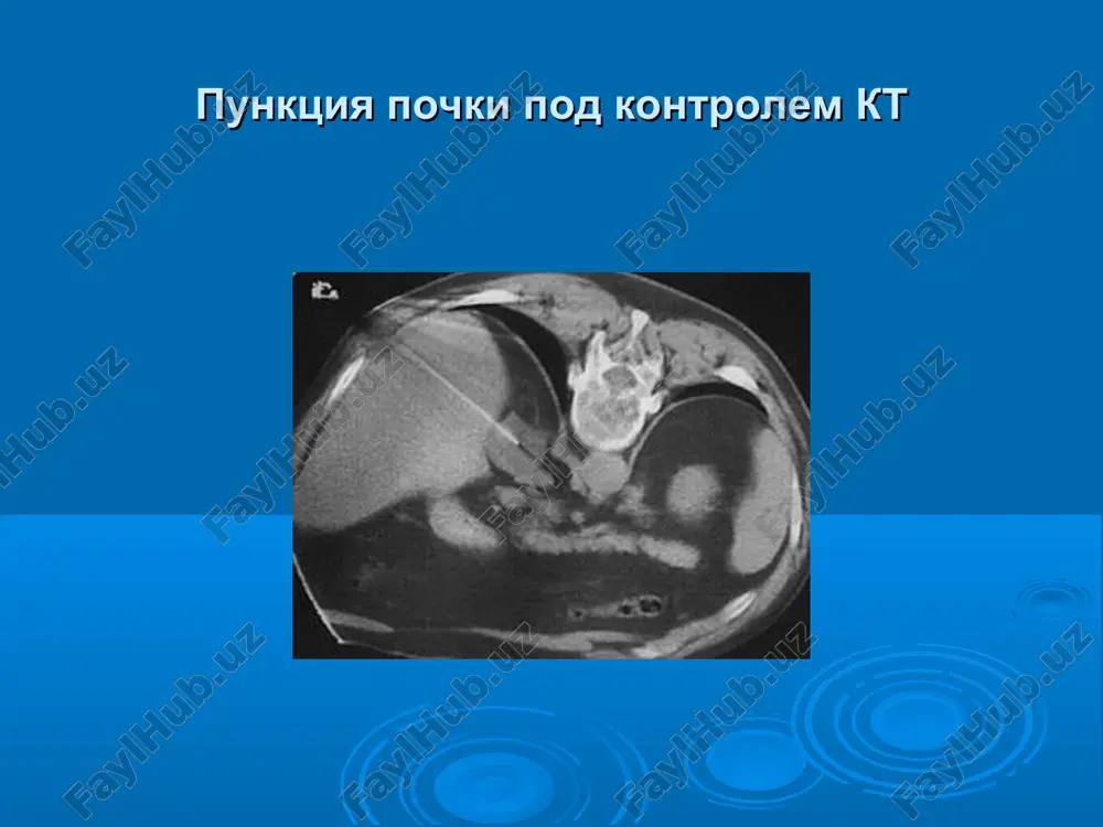 endoskopicheskaya urologiya - Page 4