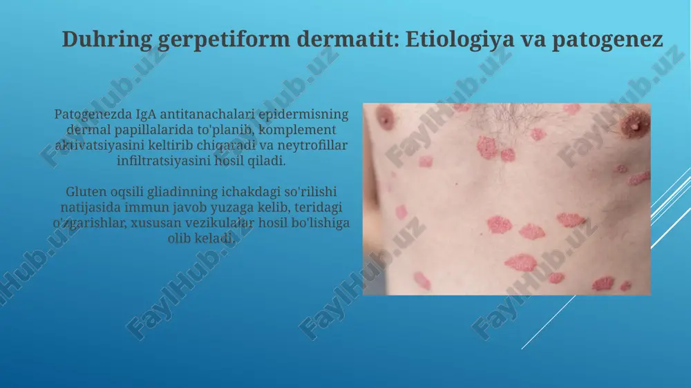 pufakli dermatozla - Page 4