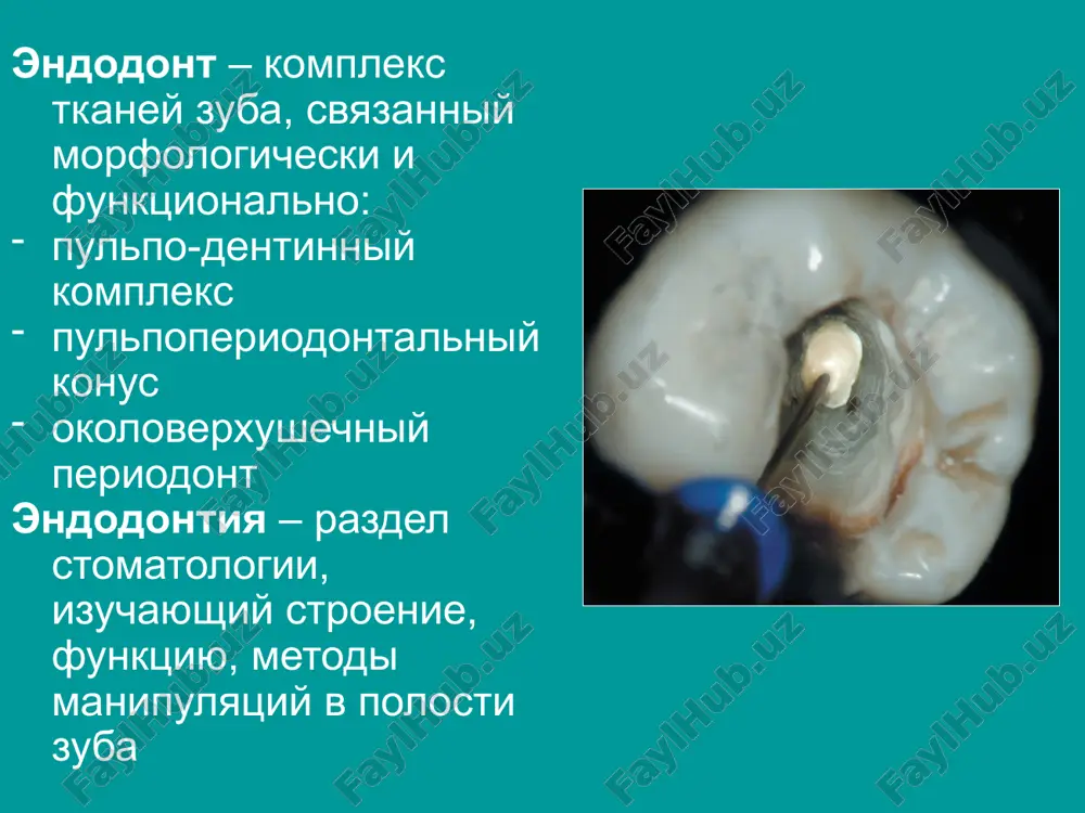 yusti srednyaya dlinna zuba 20.8mm kolichestvo korney 2(15%) 3(85%) kolichestvo kanapov 3(60%) 4(40%) lateralniy kornevoy kanal vstrechaetsya razvetvlenie kornya na verxushke redko varianti perviy molyar verxney chelyusti (27) varianti stroeniya polosti zuba raskritie polosti odnokornevogo zuba vtoroy molyar verxney chelyusti srednyaya dlinna zuba 20mm kolichestvo korney 1 (1%) 2(19%) 3(80%) kolichestvo kanalov 1 (1%) 2(2%) 3(57%) 4(40%) lateralniy kornevoy kanal vstrechaetsya razvetvlenie kornya na verxushke redko varianti vtoroy molyar verxney chelyusti (27) varianti stroeniya polosti zuba raskritie polosti odnokornevogo zuba tretiy molyar verxney chelyusti (28) varianti stroeniya polosti zuba raskritie polosti odnokornevogo zuba varianti medialniy shechniy koren molyarov verxney chelyusti kolichestvo kornevix kanalov* 1(40%) 2(60%) kolichestvo apikalnix otverstiy 1(85%) 2(15%) rasstoyanie ot verxushki kornya do 1 mm (80%) 1 -2mm (20%) apikalnogo otverstiya diametr kornevogo kanala dlya zuba s 2 kanalami 1 kanalom 1 mm ot verxushki 0.1 0-0.40 mm 0.20-0.60 mm 2 mm ot verxushki 0.1 0-0.50 mm 0.20-0.80 …