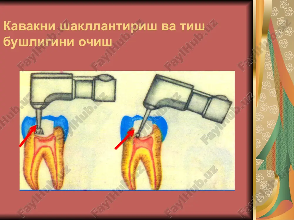 pulpitlarni davolash - Page 4