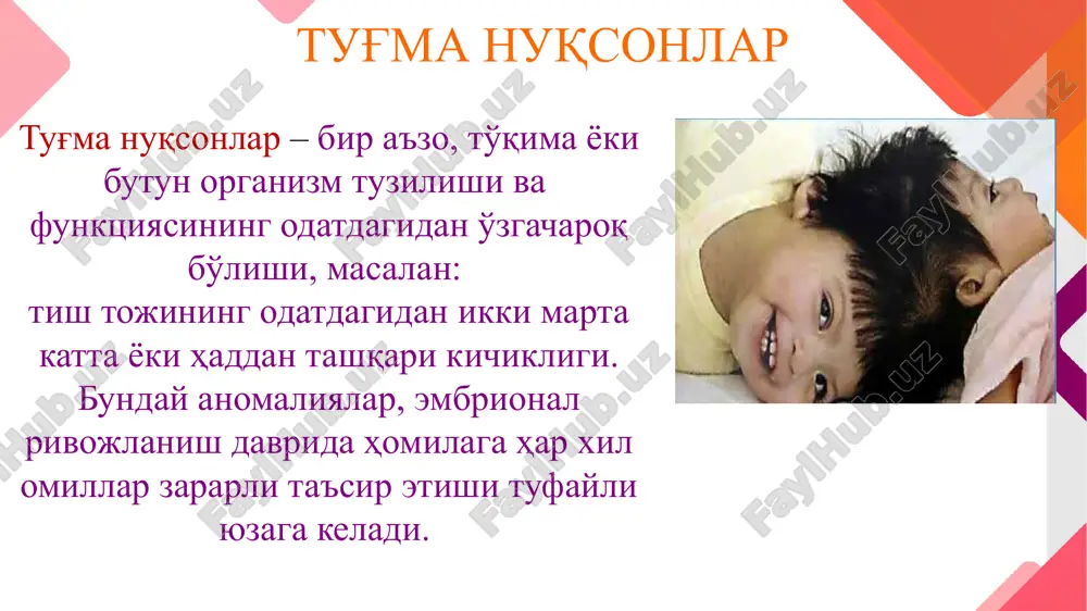 urun yo'llari tor yoki ayrimlarda atreziyaga (tug'ma yopiq yoki burun teshigi bo'lmasligi)uchragan bo'ladi. kalla suyaklari yupqalashgan, ichki yuzasida “barmoq izlari” chuqurlashgan, kalla asosini tashkil qilgan suyaklar, yonoq suyaklari va ularning ravoqlari o'smay qolgan bo'ladi. yuqori jag'da tishlar zich joylashgan, yaxshi rivojlanmagan ularning shakli o'zgargan, oligodentiya, (5-tishdan ko'p tishlar chiqmagan) makrodentiya( tish toj qismi kattalashishi) kabi simptomlar kuzatiladi; tanglay chuqur, tug'ma kemtikli bo'lishi mumkin. shakli o'zgargan quloq supralari past joylashgan. eshitish qobiliyati ham past bo'ladi 22 og'iz bo'shlig'i shilliq pardasining rivojlanish anomaliyalari shilliq parda rivojlanishi bilan bog'liq anomaliyalar bolalarda ko'p uchraydi. ayrimlarda bu mustaqil anomaliya bo'lsa, boshqalarda (og'iz-yuz barmoqlar sindromi, og'iz daxlizida ko'plab shilliq parda tortmalari shaklida uchraydigan) murakkab nuqsonlar belgisi sifatida namoyon bo'ladi yuqori lab yuganchasining kaltaligi yuqori lab yuganchasining kaltaligi til yuganchasining kaltaligi. til yuganchasining kaltaligi. yuqori lab va tanglay tug'ma nuqsonlari chastotasi dunyoning turli qit'a va mamlakatlarida bolalarning yulttn bilan tug'ilish chastotasi turlichadir. oxirgi 40 yil davomida evropada, …