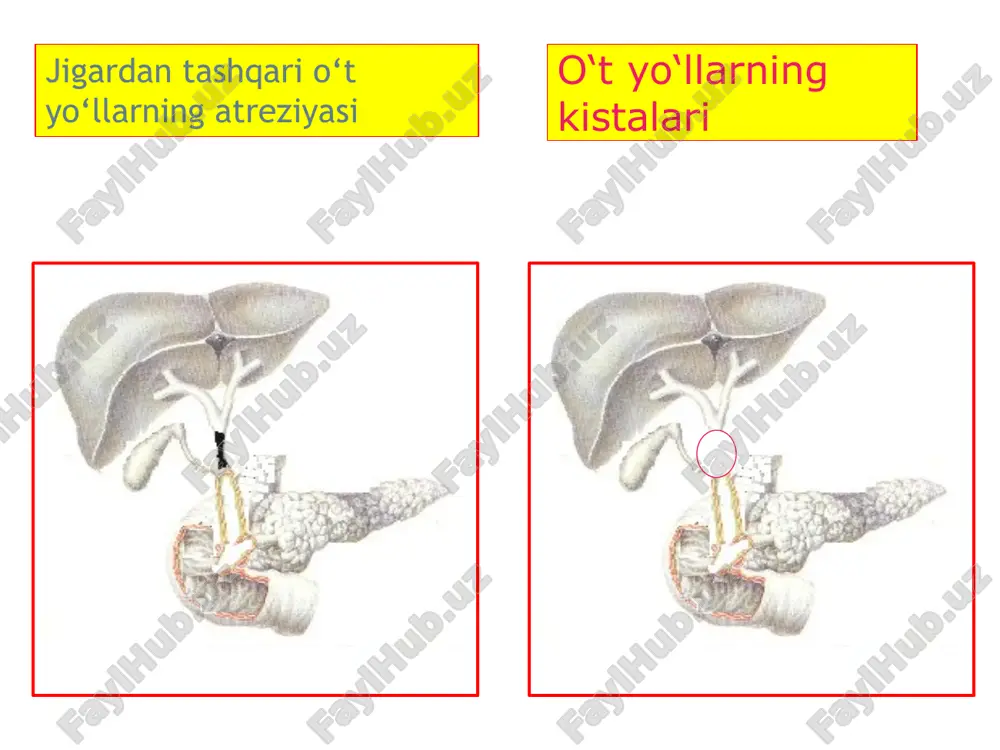 ati mexanik sariqlikda jigar yetishmovchiligini davolashda eritrotsitar farmakotsitlarni ahamiyati xolangit va mexanik sariqlik bilan asoratlangan o‘t tosh kasalligini davolashda lazeroterapiyani ahamiyati mexanik sariqlikda xolangitni oldini olish va davolashda sporobakteriinni ahamiyati mexanik sariqlikni davolashda peritoneal suyuqlikni ahamiyati mexanik sariqlikda jigar yetishmovchiligini davolashda gepa–mers dori vositiasini ahamyati image1.jpeg image2.png image3.jpeg image4.jpeg image5.png image6.png image7.png image8.png image9.jpeg image10.jpeg image11.png image12.jpeg image13.png image14.png image15.png image16.png image17.png image18.png image19.png image20.png image21.png image22.png image23.png image24.png image25.jpeg image26.jpeg image27.png image28.png image29.png