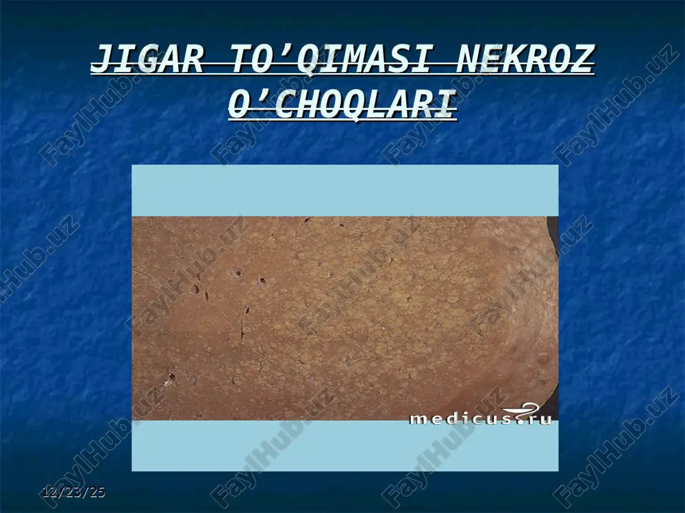jigar sirrozi - Page 4