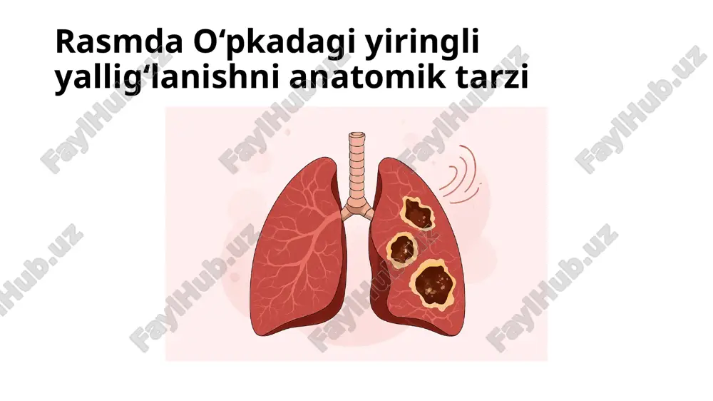 yil. pdfbox.uz 2. o‘pka o‘tkir yiringli destruktiv kasalliklari. tibbiyot bo‘limi, packpdf.com. packpdf.com 3. arxiv.uz. o‘pkaning yiringli kasalliklari – referatlar to‘plami. arxiv.uz image1.jpeg image2.jpeg image3.jpeg image4.jpeg image5.jpeg image6.jpeg image7.jpeg image8.jpeg /docprops/thumbnail.jpeg