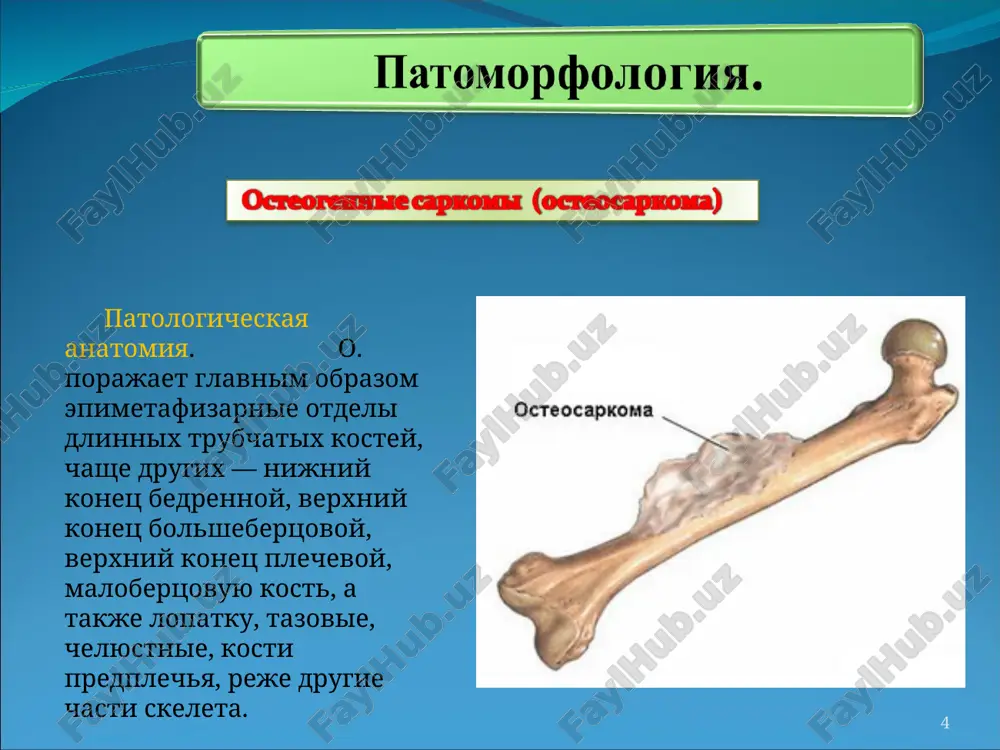 hnix opuxolyax. * * * krome opisannix vishe klinicheskix proyavleniy raka, dlya diagnostiki ispolzuyutsya: * radioizotopnoe skanirovanie skeleta, pri kotorom otsenivaetsya pogloshenie kostyu vvedennogo radioaktivnogo veshestva, viyavlyaet v takix sluchayax aktivniy protsess kosteobrazovaniya. * pri kompyuternoy tomografii vidni utolshenniy uchastok narujnogo (korkovogo) sloya kosti i massi myagkoy tkani za predelami kosti. * * dlya togo chtobi otsenit stepen razrastaniya opuxoli, pribegayut k arteriografii – rentgenologicheskomu issledovaniyu sosudov s primeneniem krasiteley. * poskolku osteosarkomi cherez krovotok v kontse kontsov dayut metastazi v legkie, provodyat takje kompyuternuyu tomografiyu grudnoy kletki. * pozitronno-emissionnaya tomografiya, pozvolyayushaya obnarujit opuxoleviy protsess (metastazi) v lyubom organe tela * * okonchatelniy diagnoz ustanavlivayut s pomoshyu otkritoy ili tonkoigolnoy biopsii: mikroskopicheskoe issledovanie vzyatoy tkani obnarujivaet sarkomatoznie veretenoobraznie kletki, produtsiruyushie nemineralizovannuyu kost. * lechenie v izraile doljno isxodit iz togo fakta, chto ne menee chem u osnovnoy chasti patsientov k momentu ustanovleniya diagnoza uje imeyutsya vtorichnie opuxoli, ili metastazi, v …