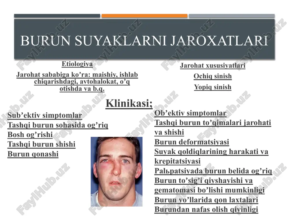 suprasining qisman yoki butunlay uzilishi kuzatiladi. jarohat paytida quloq suprasini infeksiya bilan zararlanishi yoki tibbiy yordamni o‘z vaqtida ko‘rsatilmasligi bemorda quloq suprasi xondroperixondritini rivojlanishiga, keyinchalik tog‘ayni yemirilishiga va quloq suprasi shaklini buzilishiga olib kelishi mumkin. tashqi eshituv yo‘li va nog’ora pardani jarohatlanishi ichki quloq jarohatlari sinishlarning har bir shakli o‘ziga xos klinik belgilar bilan namoyon bo‘ladi. chakka suyagi piramidasini uzunasiga sinishi odatda kalla suyagi asosini ko‘ndalang sinishi bilan birga kechadi. aksariyat hollarda bunday sinishda nog‘ora pardani yirtilishi, quloqdan qon, ba’zan orqa miya suyuqligini oqishi kuzatiladi. eshituv va muvozanat a’zosi faoliyatlarini buzilishga qaramasdan, ular qisman saqlanib qolinadi. perinevral shish va gematomani rivojlanishi va yuz asab tolasini qisilishi natijasida yuz asab tolasining qisman yoki to‘liq falaji rivojlanadi. chakka suyagi piramidasini ko‘ndalang sinishi kalla suyagi asosini uzunasiga sinishi bilan birga kechadi. bunday sinishda odatda nog‘ora parda zararlanmaydi, quloqdan qon yoki orqa miya suyuqligi oqmaydi. sinish chizig‘i ichki quloq ustidan o‘tishi natijasida ichki eshituv …