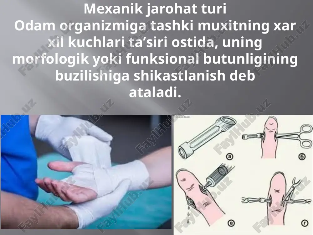 b turadi - artikulyar yuzalarning qisman aloqasini saqlab turish. shikastli dislokatsiyalar, o'z navbatida, yangi (uch kungacha), eskirgan (uch haftagacha) va eski (uch haftadan ortiq) bo'linadi. . e’tiboringiz uchun rahmat image2.png image3.png image4.png image5.png image6.png image7.png image8.png image9.png image10.png image11.png image12.png /docprops/thumbnail.jpeg