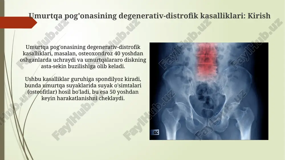 ydi. davolash usullari (konservativ) dorivor terapiya og'riqni kamaytirish va yallig'lanishni nazorat qilish uchun nsaidlar, opioid analjeziklar va mushak relaksantlarini o'z ichiga oladi, dozalash shifokor tomonidan belgilanadi. fizioterapiya massaj, davolash jismoniy mashqlari va elektroforez kabi usullarni o'z ichiga oladi, maqsad - mushaklarni mustahkamlash va harakatchanlikni yaxshilash. davolash usullari (jarrohlik) diskektomiya - bu umurtqa pog'onasi jarrohligining keng tarqalgan turi bo'lib, umurtqa asablariga bosim o'tkazadigan shikastlangan diskning bir qismi yoki butunlay olib tashlanadi. umurtqa pog'onasini fiksatsiyalash - bu umurtqalarni metall implantlar yordamida birlashtirish orqali umurtqa pog'onasini barqarorlashtirish uchun ishlatiladigan jarrohlik usul. prognoz va profilaktika prognoz ko'pincha kasallikning erta bosqichida aniqlanganligi, bemorning yoshi va umumiy salomatligi kabi omillarga bog'liq. kasallikning zo'ravonligi 20-50% holatlarda yaxshilanishni ko'rsatadi. profilaktika uchun muntazam jismoniy mashqlar, vaznni nazorat qilish va ergonomik ish joyini ta'minlash muhim. umurtqa pog'onasi uchun xavf omillarini kamaytirish 30%gacha holatlarda kasallikni oldini oladi. e'tiboringiz uchun rahmat image1.png image2.jpg image3.jpg image4.jpg image5.jpg image6.jpg image7.jpg image8.jpg image9.jpg image10.jpg image11.jpg …