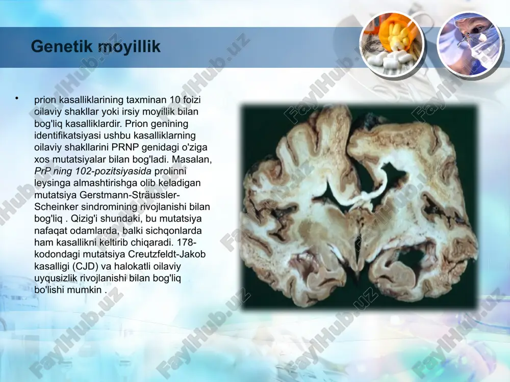 hini o'lchash usulini ishlab chiqishga harakat qilishdi , ammo bu maqsadda qon kabi materiallardan foydalanishning to'liq qabul qilingan usullari hali ham mavjud emas. nyu-york tadqiqotchilari guruhi miya to'qimalarida uning ko'pligi yuz milliarddan bir (10-11 ) bo'lsa ham, prp sc ni aniqlash usulini tasvirlab berdi . ushbu usul kuchaytirishni surround deb nomlangan yangi texnologiya bilan birlashtiradi. optik elyaf immunoassay ( sofia ) (qo'shni tolalarning optik immunoassay uchun qisqa) va prp sc ga qarshi ba'zi o'ziga xos antikorlar . namunada mavjud bo'lishi mumkin bo'lgan har qanday prp sc ni to'playdigan kuchaytirilgandan so'ng , namuna lyuminestsent bo'yoq va o'ziga xoslik uchun antikorlar bilan etiketlanadi va nihoyat mikrokapillyar naychaga yuklanadi . keyin bu trubka maxsus apparatga joylashtiriladi, shunda u butunlay optik tolalar bilan o'ralgan bo'ladi va naychaga chiqarilgan barcha yorug'lik bo'yoq tomonidan so'riladi, ilgari lazer bilan qo'zg'atiladi . prp sc ni hatto prion o'zgarishining oz sonli tsikllaridan keyin ham aniqlash imkonini beradi , bu …