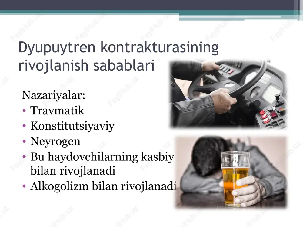 dyupyuitren kontrakturasi - Page 4