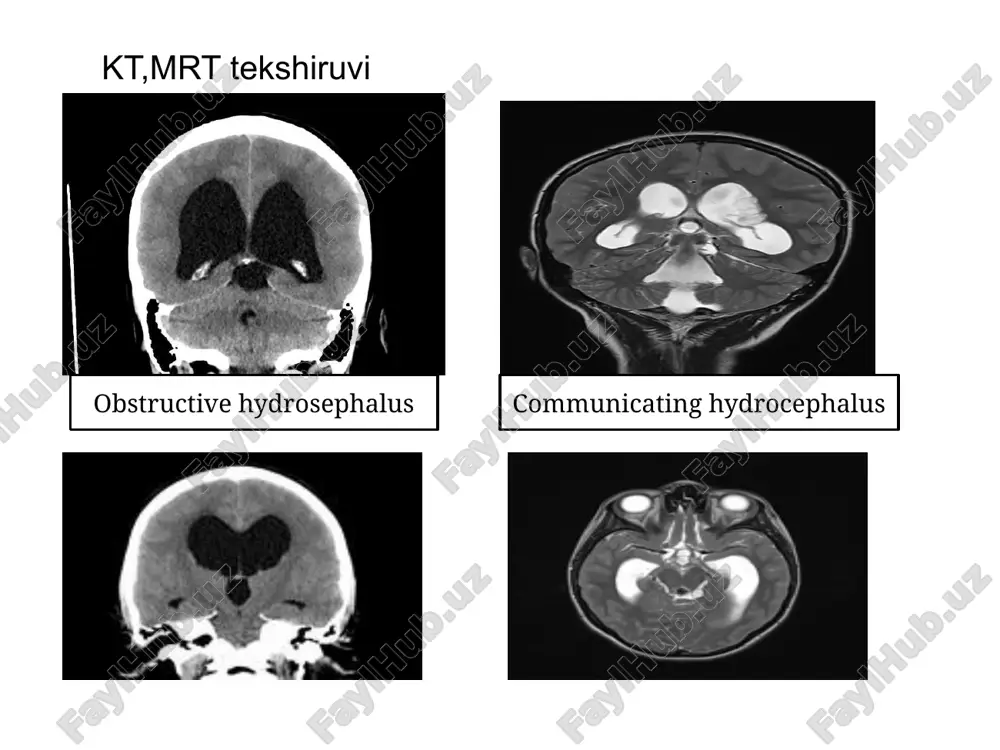 bosh miya kasalliklari nur tashxisi - Page 4