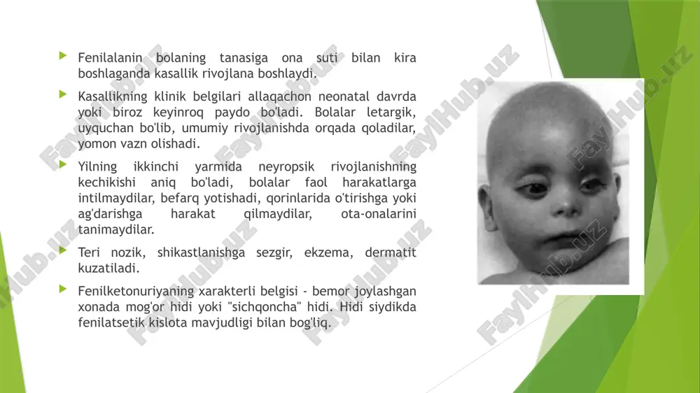 nda pigment butunlay yo'q. tirazinaza faolligi mavjud bo'lganligi sababli , ba'zi odamlarda soch, teri va ko'zlarning pigmentatsiyasi yoshga qarab kuchayishi mumkin va teri quyoshdan sarg'ayishni boshlaydi. ocl albinizm 2 bu barcha irqlarda albinizmning eng keng tarqalgan turi. ushbu kasallik ham autosomal retsessivdir, ammo boshqa xromosomada lokalizatsiya qilinadi. bunday holda, p-oqsilni kodlovchi gen ta'sir qiladi va tirozinaza sintezi normal bo'lib qoladi. ocl albinizm 3 afrikalik bemorlarda klinik fenotip ochiq jigarrang yoki sarg'ish teri va sochlar, jigarrang-ko'k irislardir. optik nervlarning ishidagi buzilishlar sezilmadi. davolash bugungi kunga qadar albinizm uchun maxsus davolash mavjud emas, faqat bemorning hayot sifatini yaxshilash uchun profilaktika choralari ishlab chiqilgan. mavjud ko'rish darajasini saqlab qolish uchun ko'zlarni quyosh nurlaridan himoya qilish kerak - bu maxsus quyoshdan saqlaydigan ko'zoynak yoki kontakt linzalarini kiyish orqali erishiladi. yorqin quyoshga ta'sir qilishdan qochish yoki terini maxsus kremlar va losonlar bilan himoya qilish kerak. agar siz ushbu tavsiyalarga amal qilsangiz, umuman olganda, albinizmning prognozi …