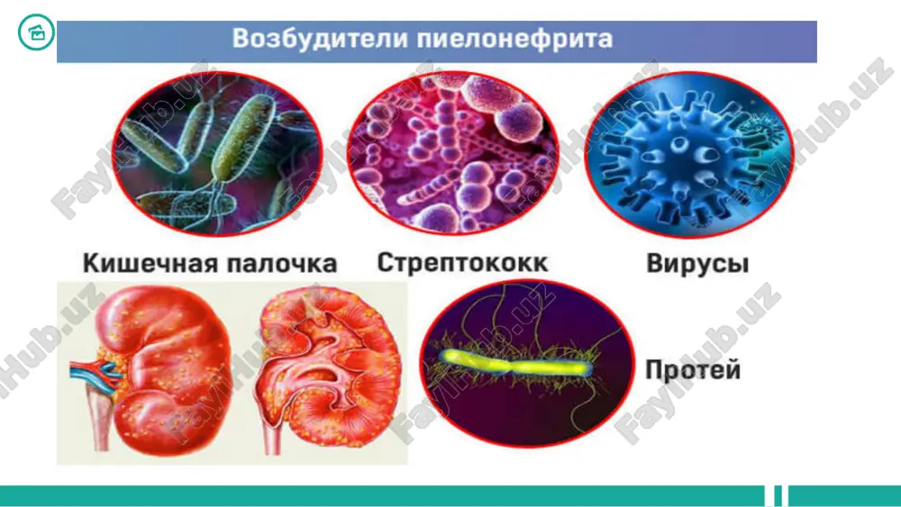 umiy prinsiplari : • antibiotiklarni buyurish siydikni bakteriologik ekishning natijalariga asoslangan bo'lishi kerak. • antibiotikogrammaning natijasini olgunga qadar keng spektorli antibiotiklar qo'llaniladi. • antibiotikoterapiyaning samaradorligi davolash boshlangandan 48-72 soat so'ng aniqlanadi. o'tkir asoratlanmagan pielonefritni davolash. • trimetoprim / sulfametoksazolni qo'llash ampitsillinga nisbatan afzalroqdir; • ftorxinolonlar – davolash kursi 7 -10 kun; • sefalosporinlar 2-3 generatsiyasi aminoglikozidlar bilan birgalikda, davolash kursi 7-10 kun. • alternativ preparatlar: aminopenitsillin / β – laktamaza ingibitorlari. antibiotikoterapiya saradorligini baxolash: • klinik: • umumiy axvolining yaxshilanishi; • tana xaroratining normallashuvi; • og'rikning yo'qolishi yoki kamayishi. • laborator: • bakteriuriyaning yo'qolishi va leykotsituriyaning bir necha marotaba kamayishi. e'tiboringiz uchun rahmat 26 image1.jpeg image2.jpeg image3.jpeg image4.jpeg