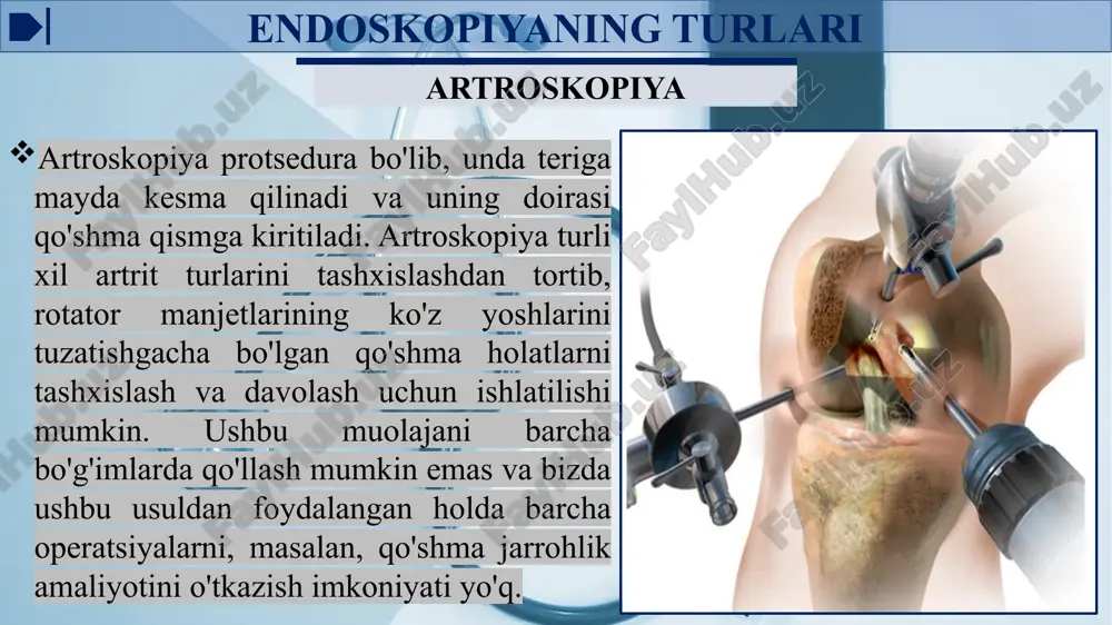 shi mumkin xavfli o'smalar, ichakning tashqi oqma yaralari, og'ir tug'ma yurak kasalligi rejali operatsiyolar istalgan paytda qilinishi mumkin, shu bilan birga bemorni jarrohlik yo'li bilan davolashga tayyorlash bir-ikki kunga, zaruriyat tug'ilib qolsa bir necha haftaga cho'zilishi mumkin image1.jpg image2.jpg image3.jpeg image4.jpeg image5.jpeg image6.jpeg image7.jpeg image8.jpeg image9.jpeg image10.jpeg arthroscope surgery /docprops/thumbnail.jpeg