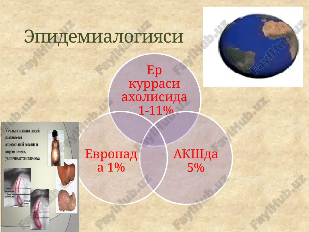 ўхтатиш имкони бўлади меъда в қизилўнгач вкв қон кетишдаги консерватив усуллар - шокка қарши куршиш - вазоконстриктор терапия (питуитрин, терлипрессин, сандостатин, нитраты) - гемостатик терапия - плазма, қон қуйиш - дезинтоксикацион терапия -гепатопротекторлар stengstaken-blakemore зонди асоратлар: асфиксия, аспирацион пневмония, қизилўнгач ёрилиши тўғри нотўғри вирус этиологияли жигар циррозини даволаш: 1.пассив интерферонизация (альфа2-интерферон 1 млн хб 10-15 кун, м/о.га 2.актив интерферонизация ва иммуномодуляция (тимолин, т-активин). 3.гепатопротекторлар, холестаз бўлмаса, эссенциале вена ичига ва перорал. 4.пешоб ҳайдовчилар.5.витаминлар. 6.дезинтоксикацион таъсирга эга препаратлар (орнецил жигар трансплантасияси эътиборингиз учун рахмат! image3.jpeg image4.jpeg image5.jpeg image6.jpeg image7.jpeg image8.jpeg image9.jpeg image10.gif image11.jpeg image12.emf oleobject1.bin image13.jpeg image15.jpeg image16.jpeg image17.jpeg image14.jpeg image18.jpeg image19.jpeg image20.jpeg image21.jpeg image22.jpeg image23.jpeg image24.jpeg image25.jpeg image26.png image27.jpeg image28.jpeg image29.jpeg image30.jpeg image31.gif image32.png image33.jpeg image34.jpeg image35.jpeg image36.gif 46,70% 13,30% 13,30% 6,70% 6,70% вирусли этиологияли алкогол этиологияли аралаш цирроз пик циррози криптоген цирроз /docprops/thumbnail.jpeg