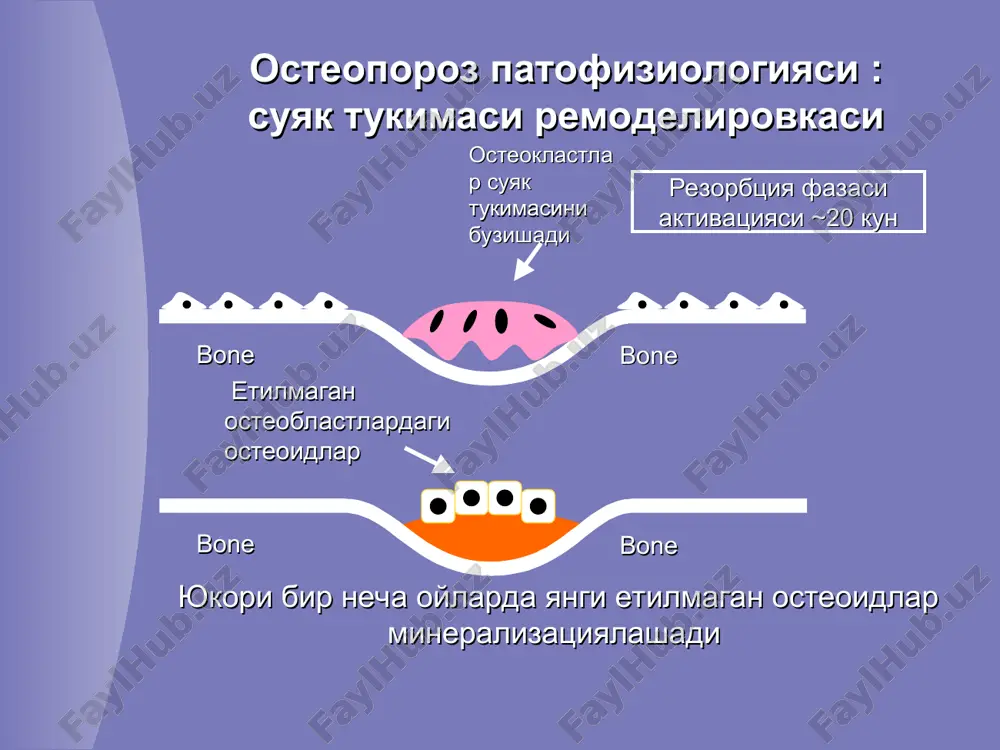 ши ёшга боглик (карилик) остеопорози одатда 80 ёшдан кейин учрайди, тахминан 1/3 холатларда эркакларда кузатилади касаллик асосий сабаби булиб суяк тукимаси шаклланиши камайиши ва буйракларни витамин d метоболизм килиш хусусиятини пасайиши витамин d дефицити кальций абсорбциясини пасайишига, окибатида паратгормон микдори ошишига олиб келади ( гиперпаратиреоз кузатилади ) ва суяк тукимаси резорбцияси кузатилади остеопороз ва ёш остеопороз кари ёшдагилар касаллиги хисобланади, бирок суяк тукимасини йукотиш жараёни бироз эрта бошланади остеопороз сезиларсиз прогрессирланади ва факат биринчи суяк синиши кузатилгандагина клиник сезиларли булади умумий суяк массаси одам ёшидан келиб чиккан холда возраст эркаклар аёллар эндокрин касалликлар иценко-кушинга касаллик / синдроми кандли диабет i типи тиреотоксикоз гипогонадизм гиперпаратиреоз ревматик касалликлар ревматоид артрит системали кизил бурича анкилозловчи спондилоартрит овкат хазм килиш касалликлари сурилишни бузилиши жигар касалликлари буйрак касалликлари сбе каналчали бузилишлар кон касалликлари миелом касаллиги лейкоз, лимфомалар генетик бузилишлар етилмаган остеогенез марфан синдроми дорилар глюкокортикоидлар антиконвульсантлар цитостатиклар тиреоид гормонлар антацидлар бошка холатлар овариэктомия иммобилизация алкоголизм …